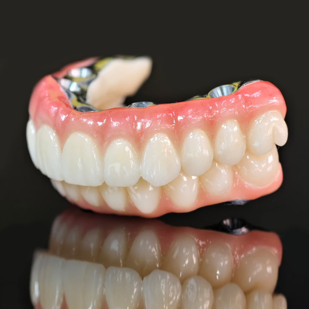 Ti-Bar Titanium Nitride Metal Frame With Zirconia Bridge For Full Arch Restoration