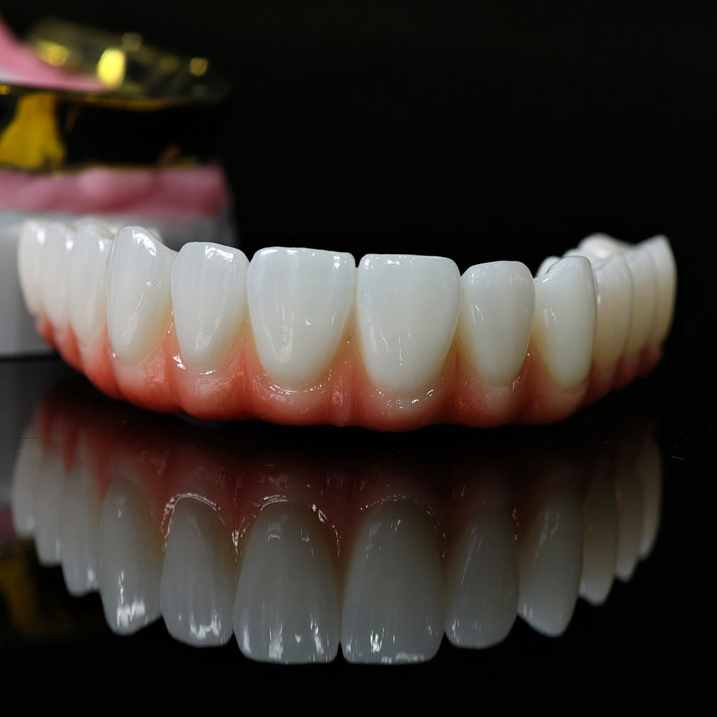 Ti-Bar Titanium Nitride Metal Frame With Zirconia Bridge For Full Arch Restoration