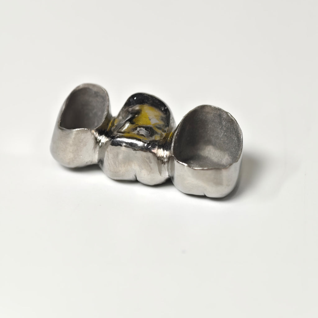 Titanium Crown With Cement Retained