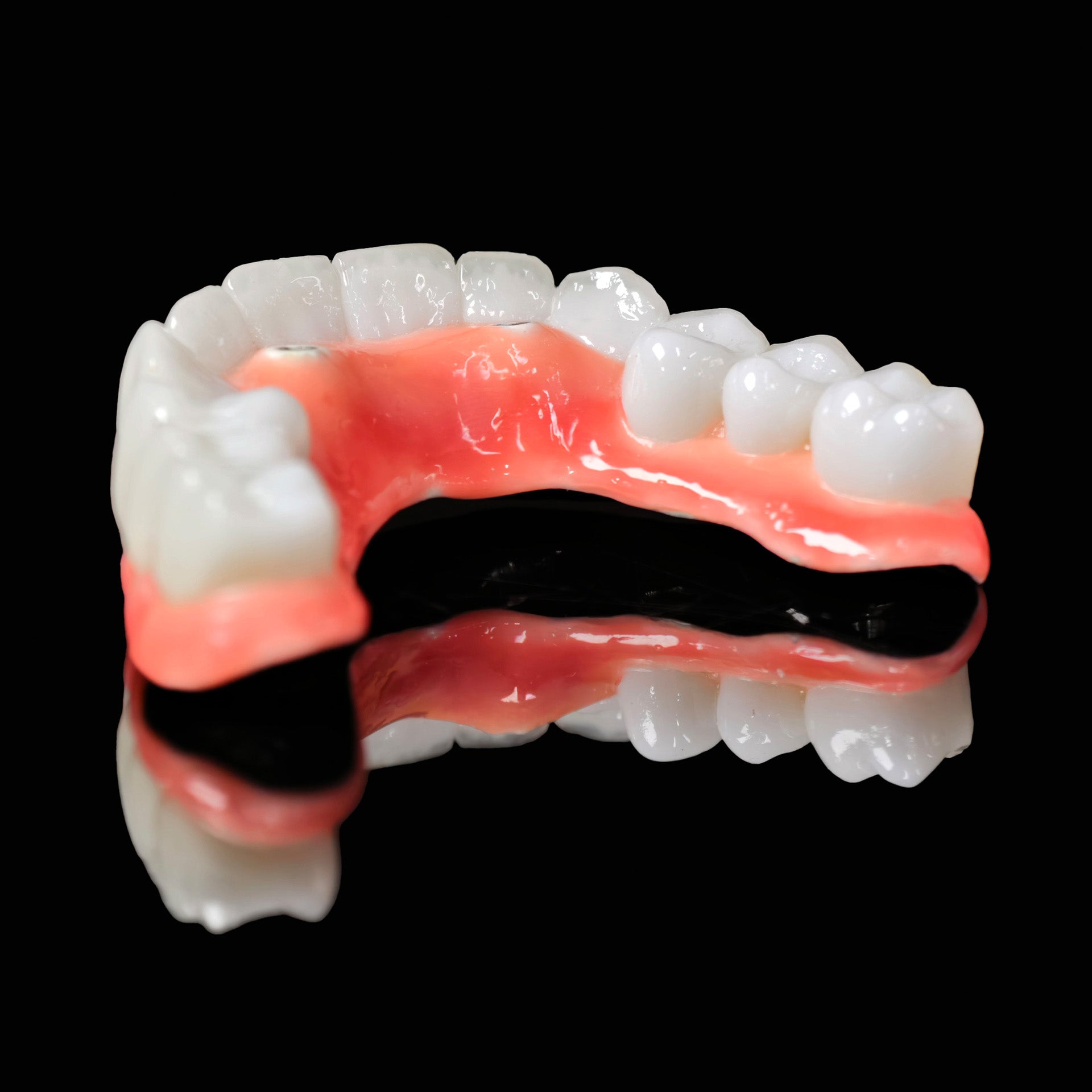Traditional Malo Bridge With Alloy Framework Covering The Gingiva