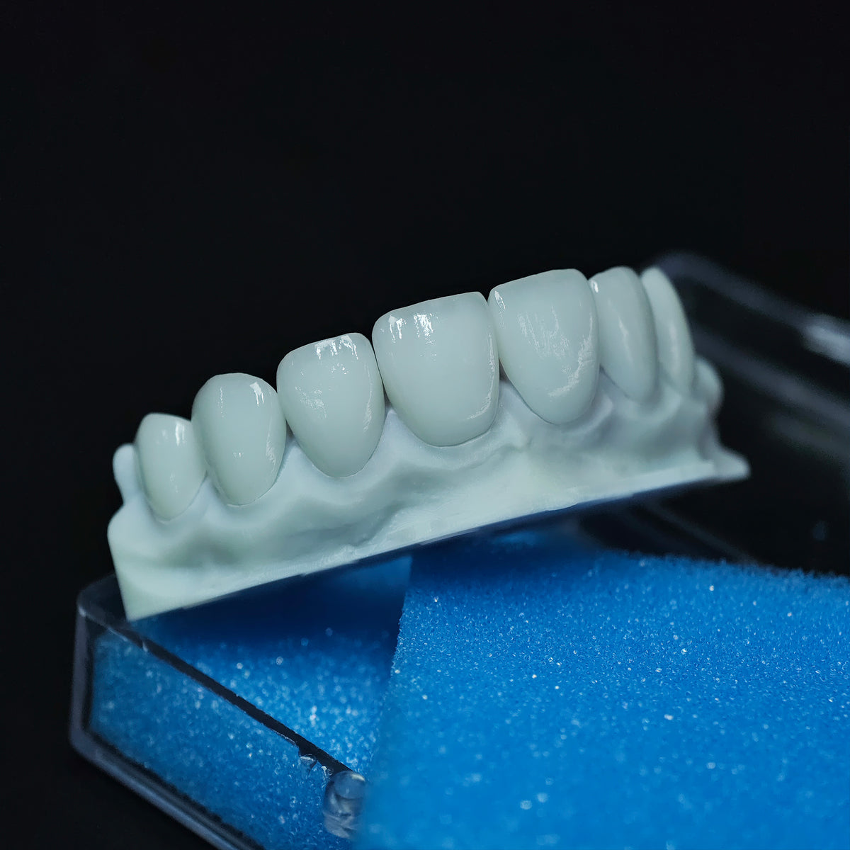 Ultra-Thin Emax Veneer. High Transparency/Translucent, Natural Shade