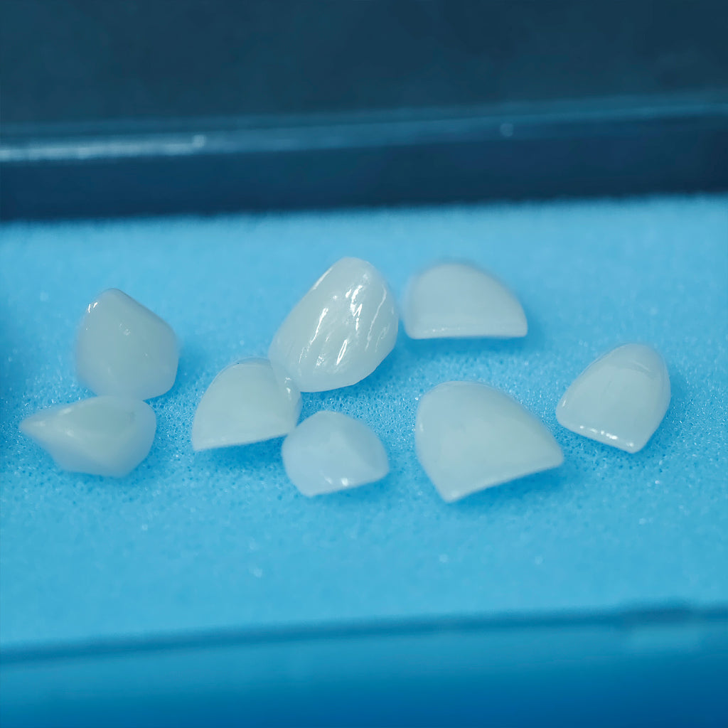 Ultra-Thin Emax Veneer. High Transparency/Translucent, Natural Shade