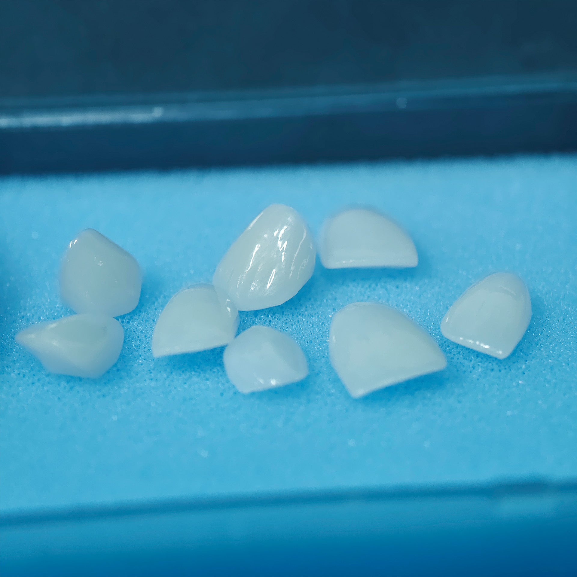 Ultra-Thin Emax Veneer. High Transparency/Translucent, Natural Shade