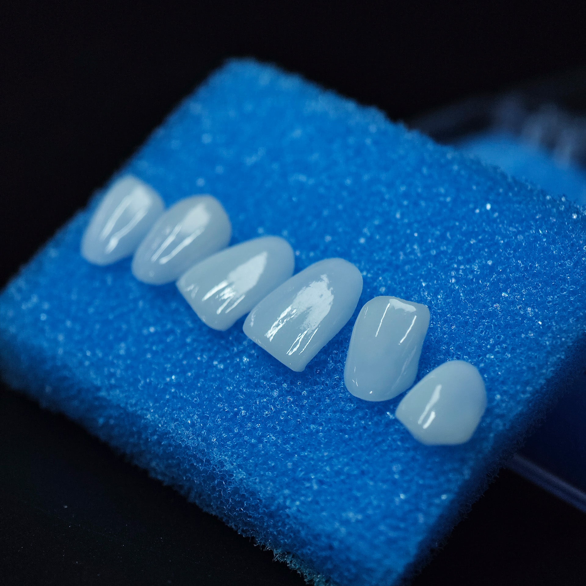 Ultra-Thin Emax Veneer. High Transparency/Translucent, Natural Shade