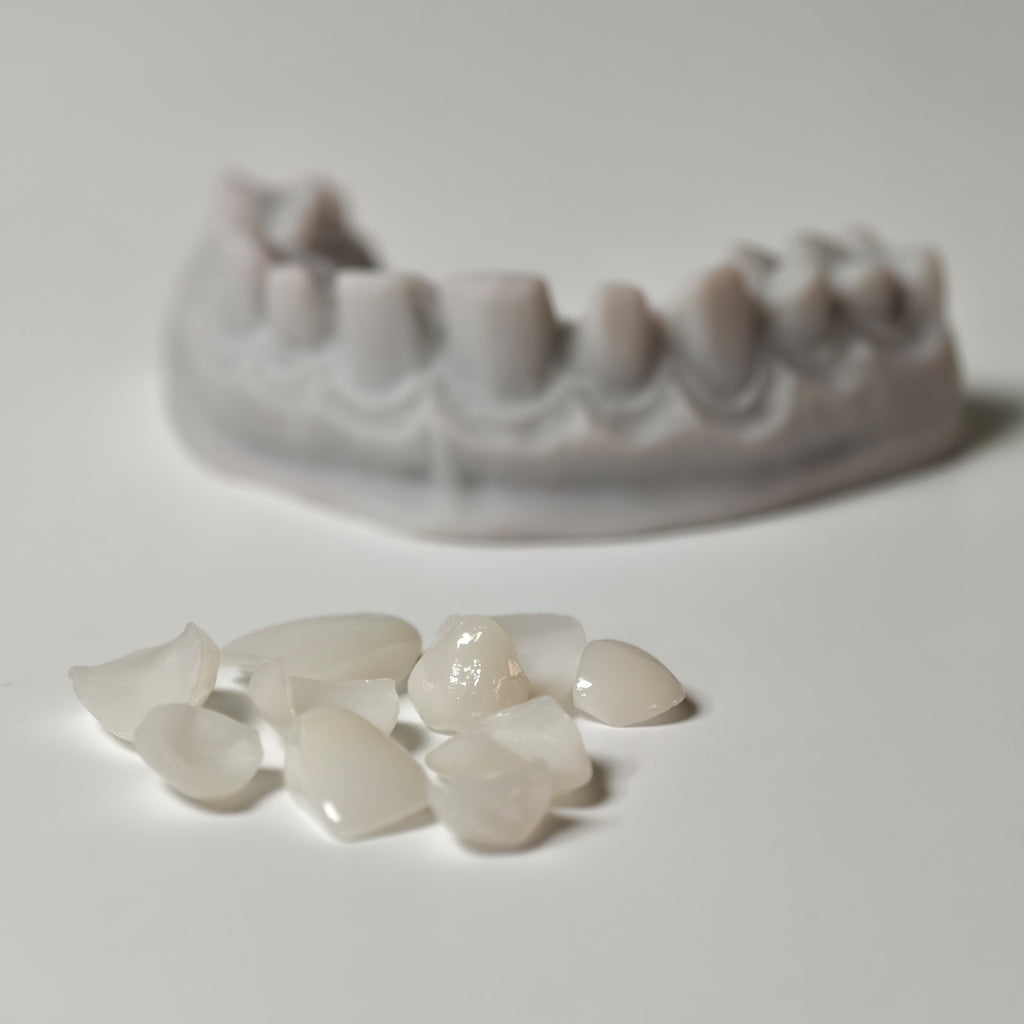 Ultra-Thin Emax Veneer. High Transparency/Translucent, Natural Shade