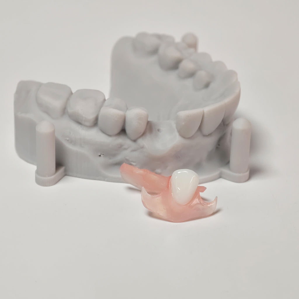 Valplast Denture Beautiful And Elastic Flexible Partial Natural Appearance