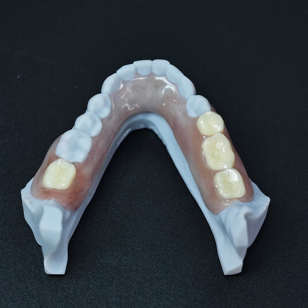 Valplast Denture Beautiful And Elastic Flexible Partial Natural Appearance