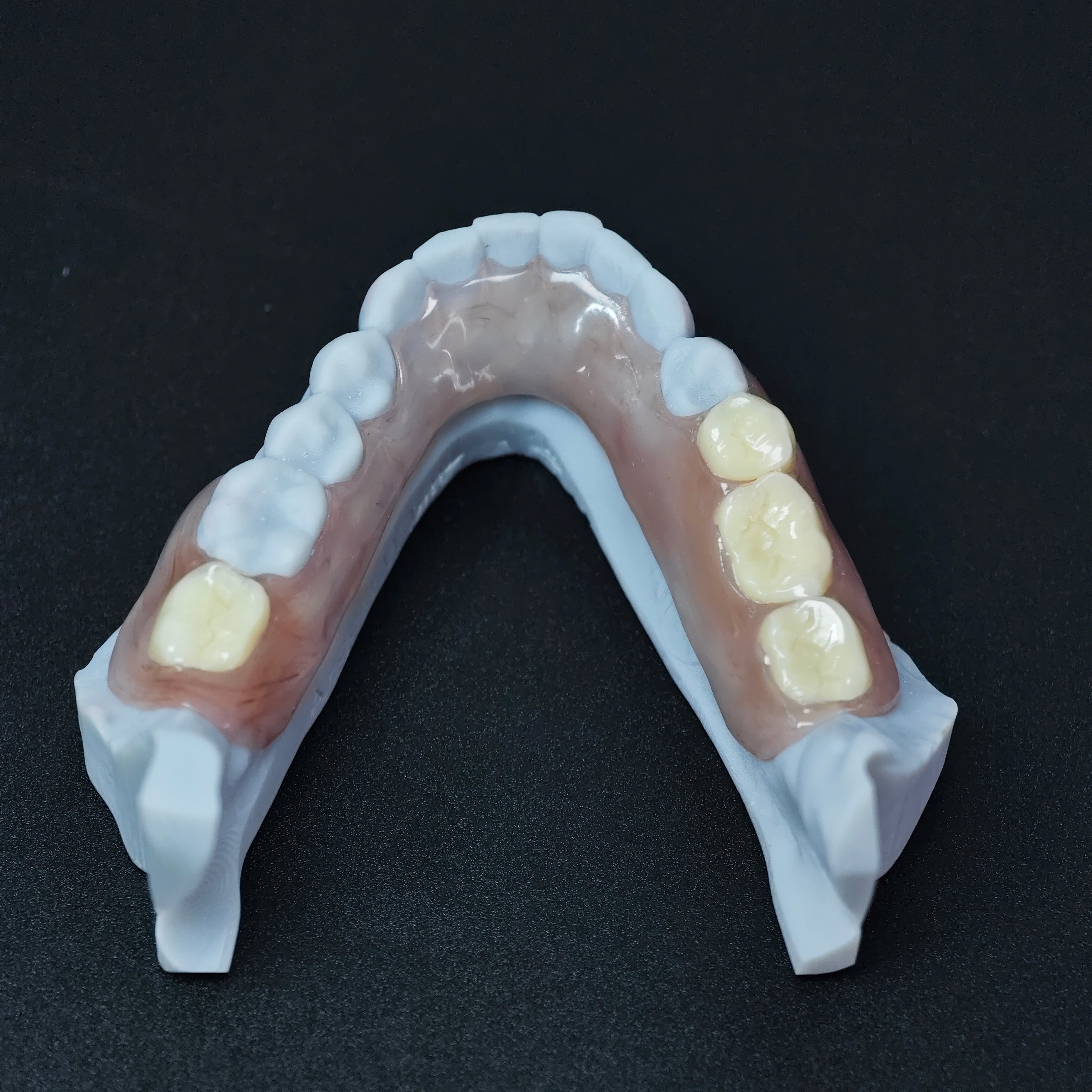 Valplast Denture Beautiful And Elastic Flexible Partial Natural Appearance