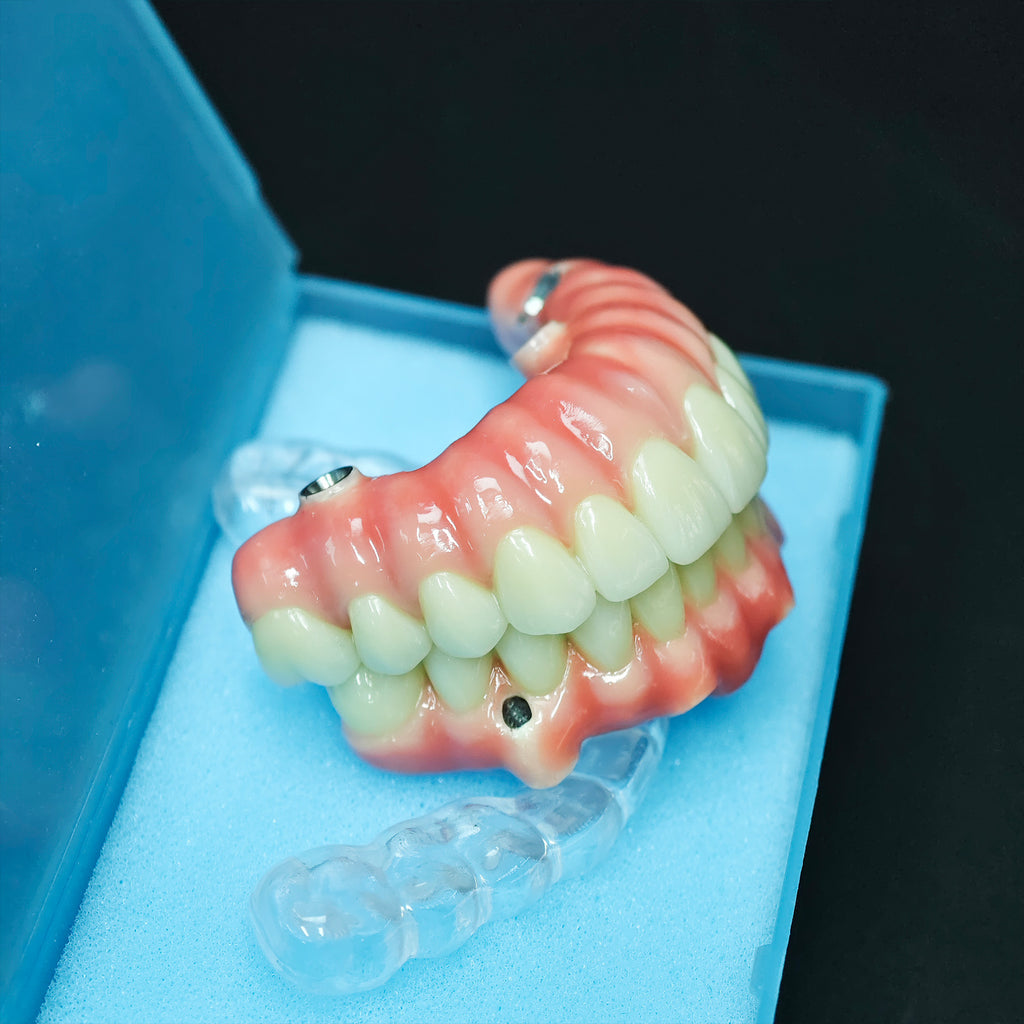 Zirconia-Enamel Hybrid Malo Bridge