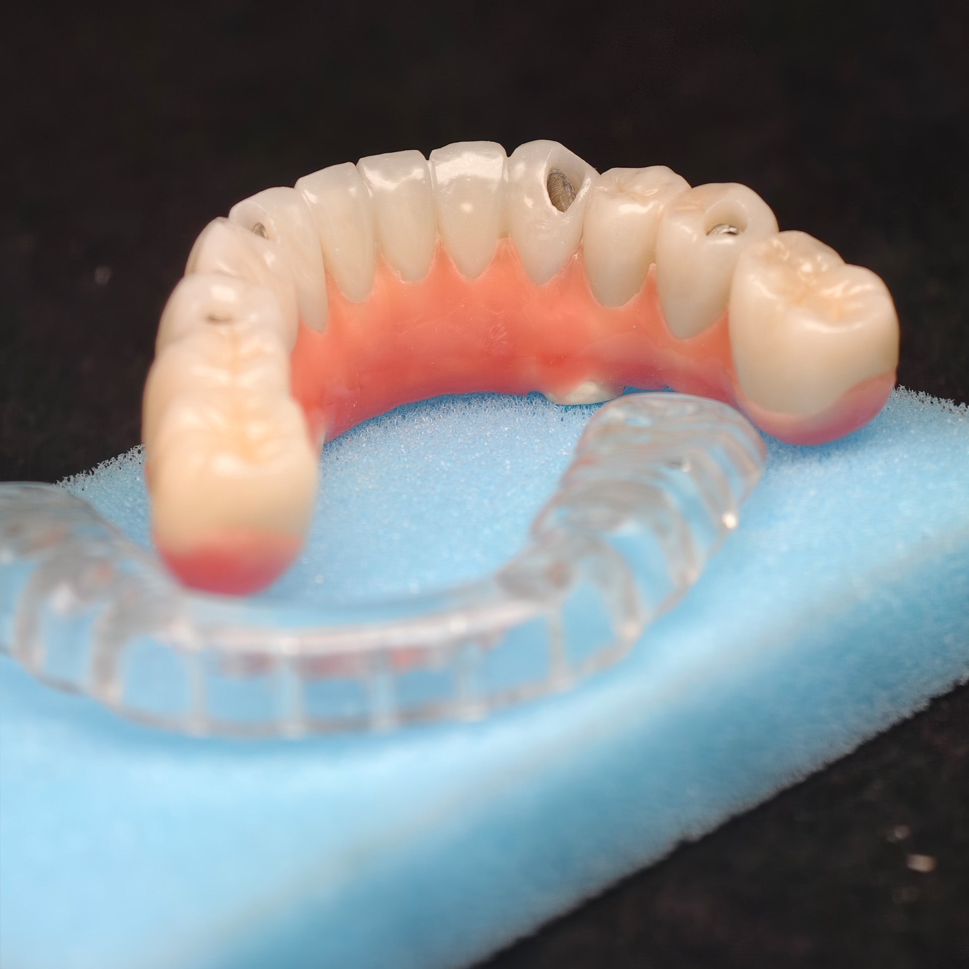 Zirconia-Enamel Hybrid Malo Bridge