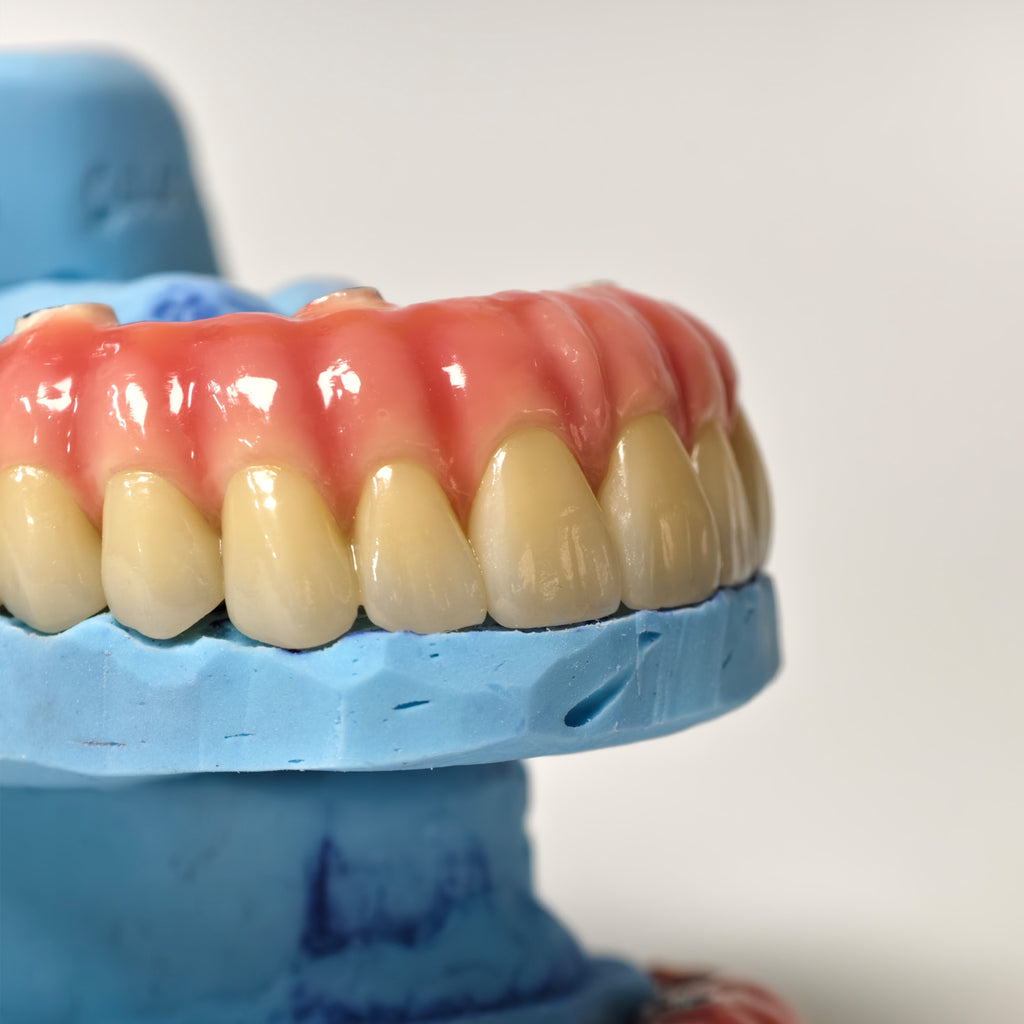 Zirconia-Enamel Hybrid Malo Bridge