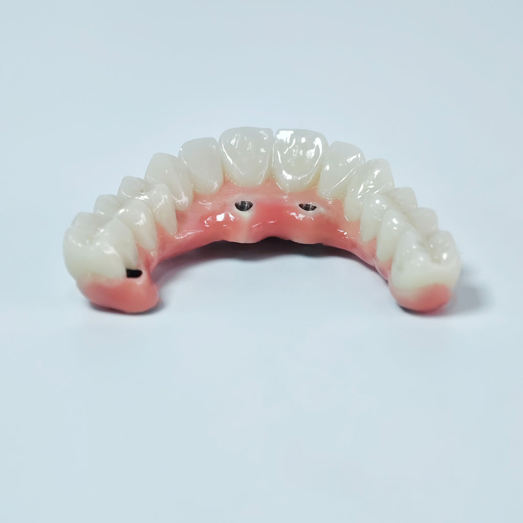 Zirconia-Enamel Hybrid Malo Bridge