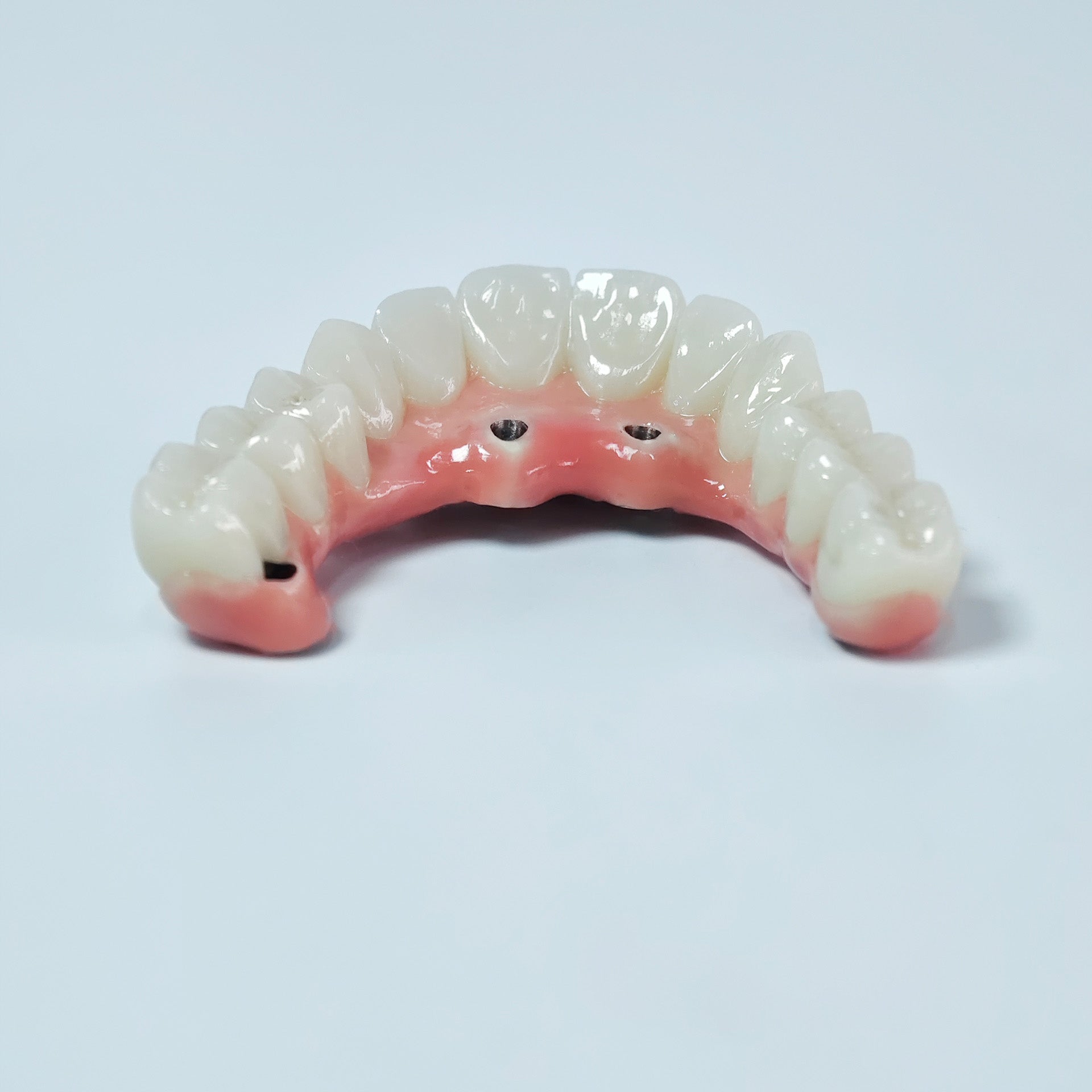 Zirconia-Enamel Hybrid Malo Bridge