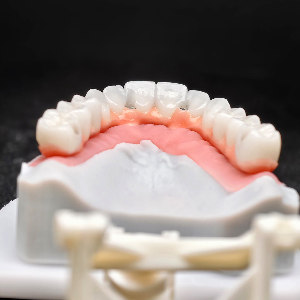 Zirconia-Enamel Hybrid Malo Bridge