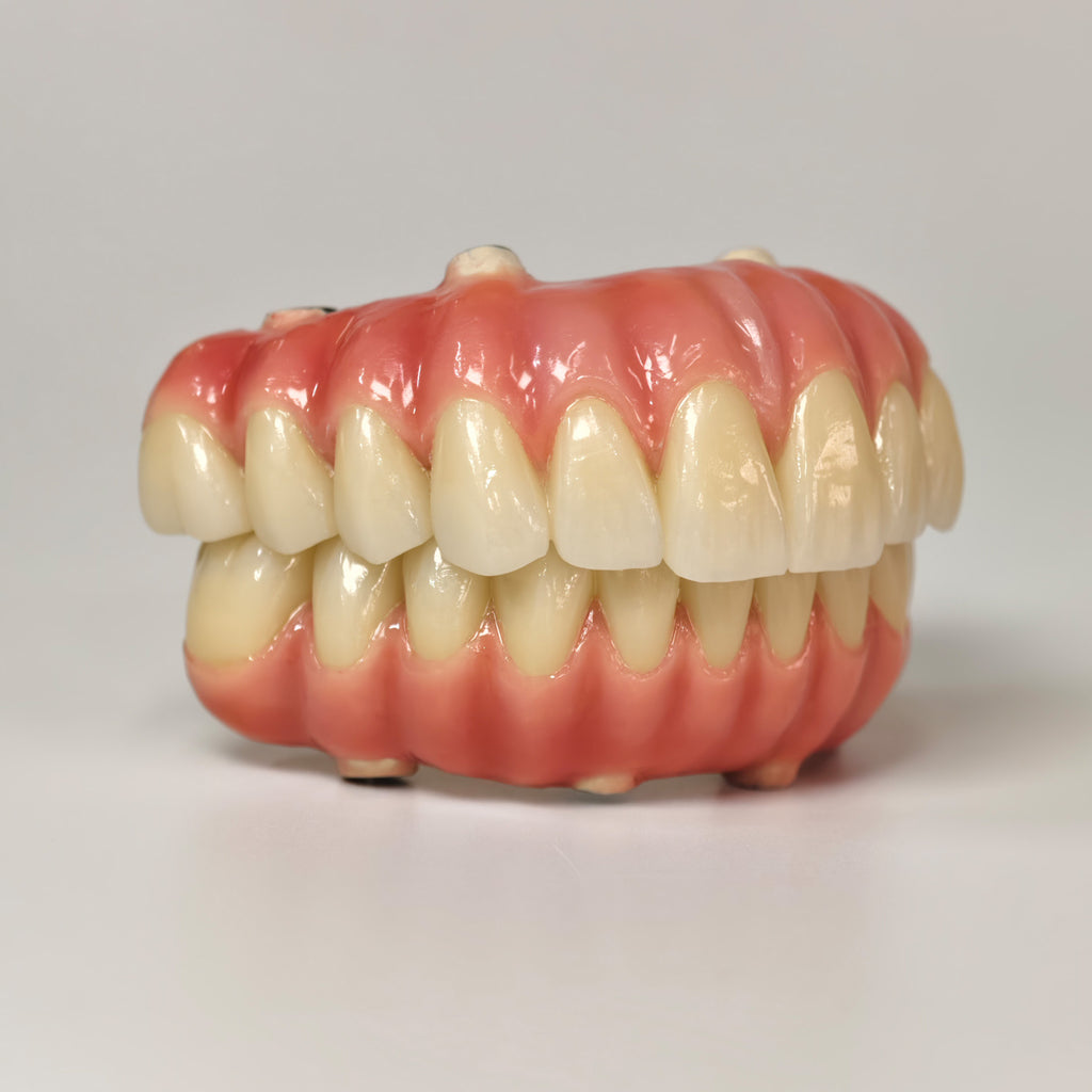 Zirconia-Enamel Hybrid Malo Bridge