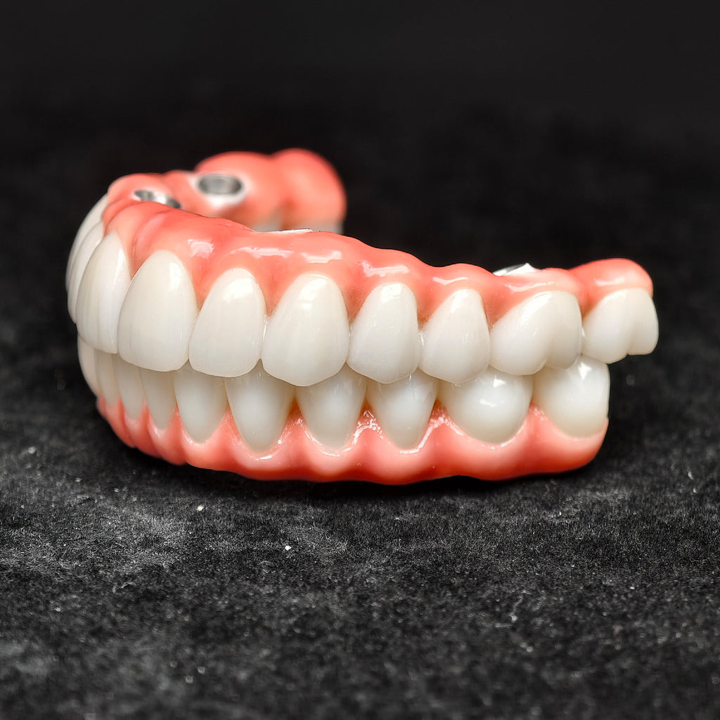 Zirconia-Enamel Hybrid Malo Bridge