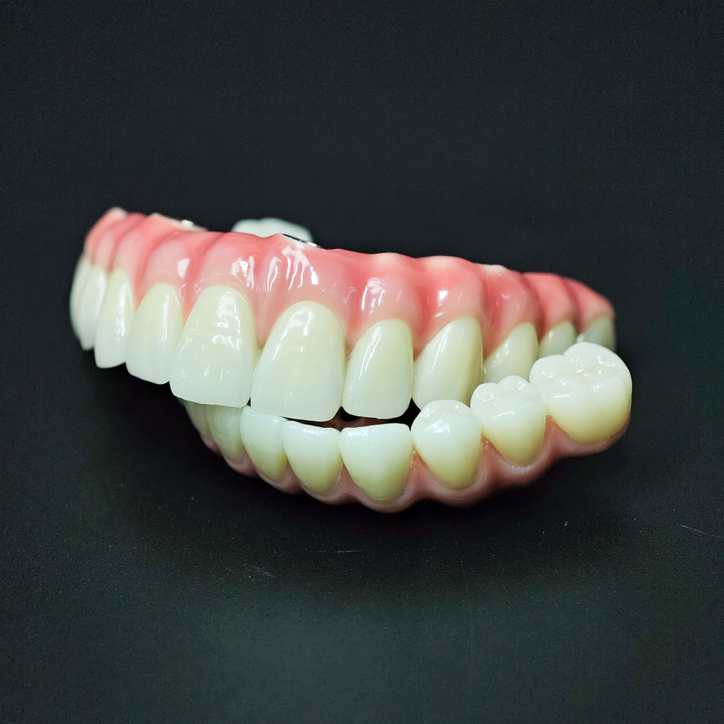 Zirconia-Enamel Hybrid Malo Bridge