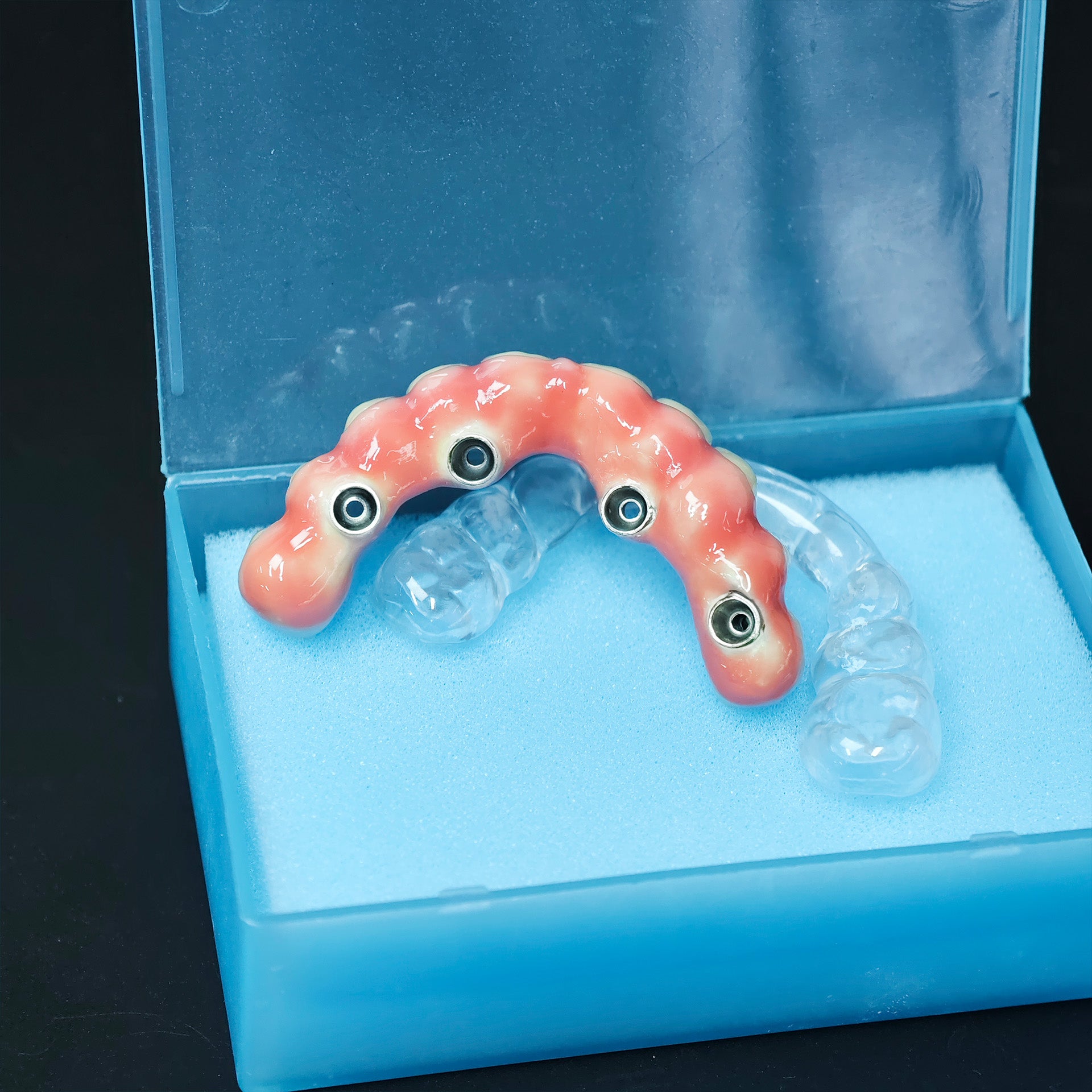 Zirconia-Enamel Hybrid Malo Bridge
