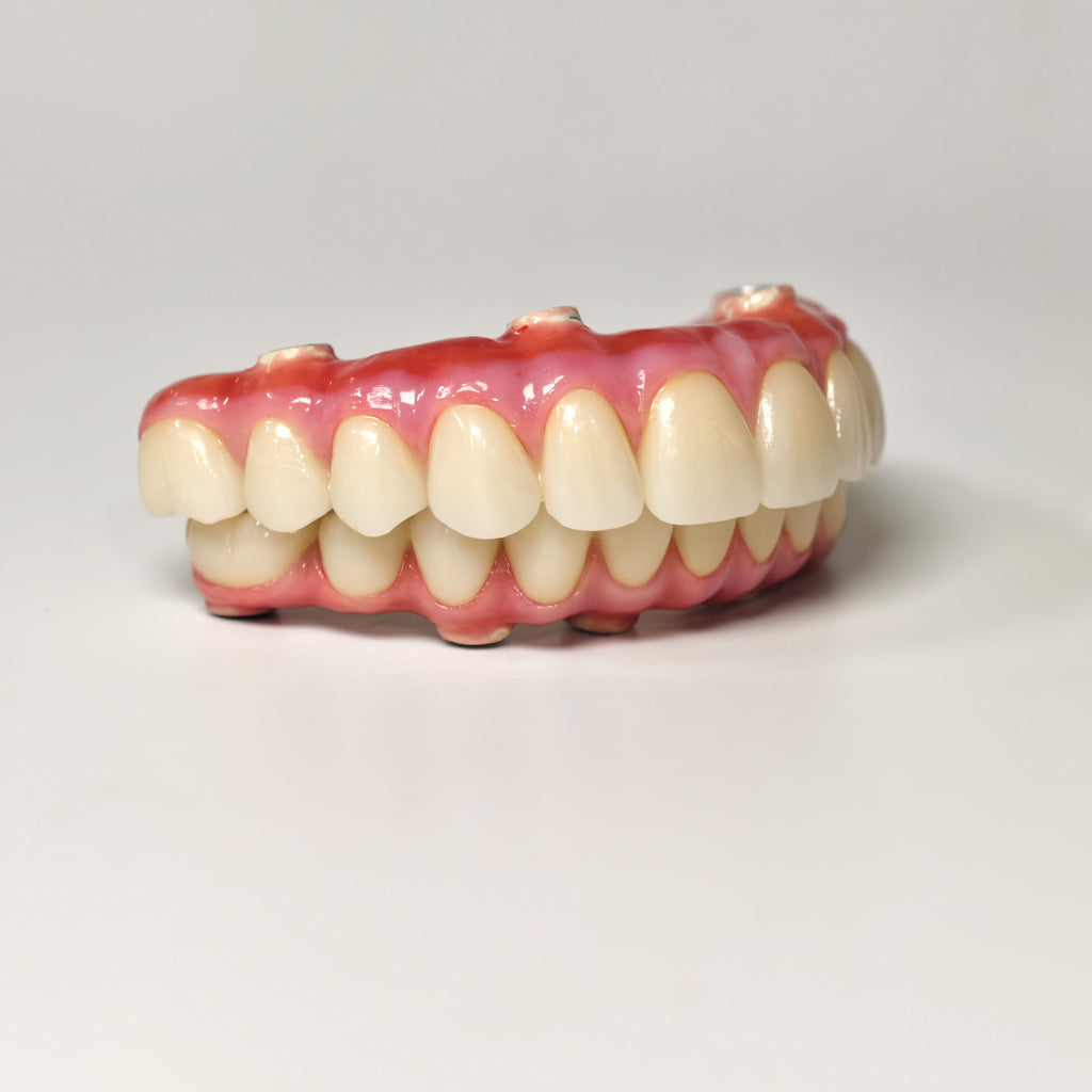 Zirconia-Enamel Hybrid Malo Bridge