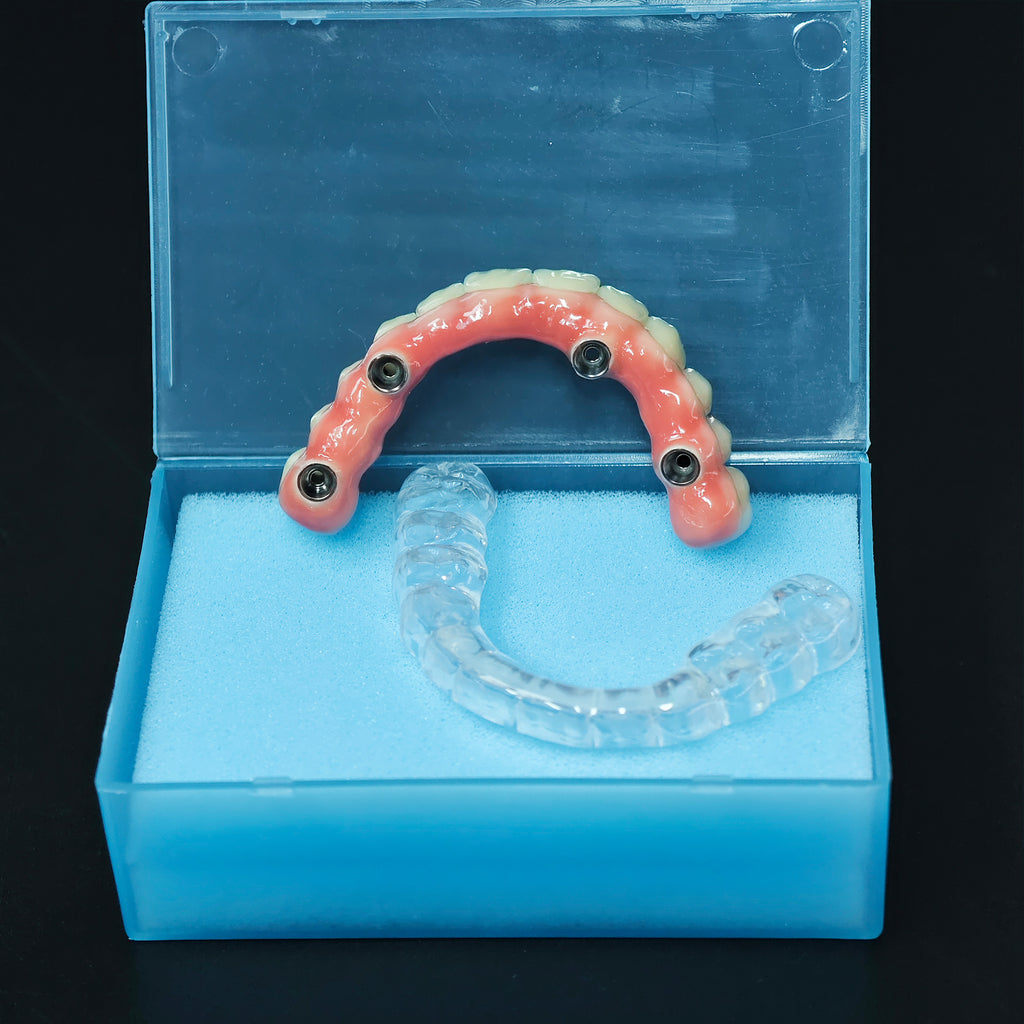 Zirconia-Enamel Hybrid Malo Bridge