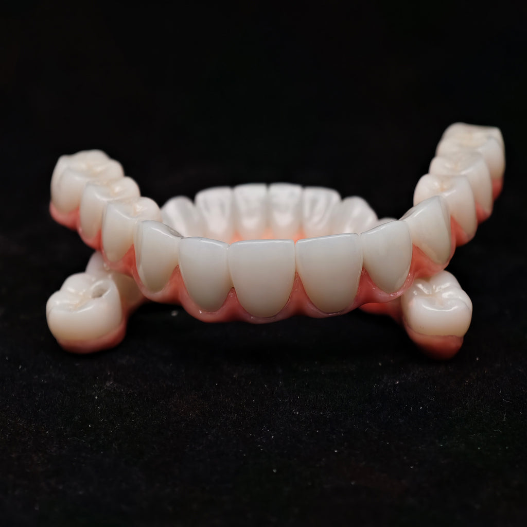 Zirconia-Enamel Hybrid Malo Bridge