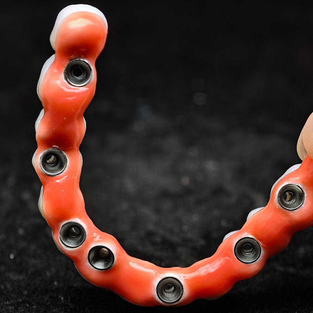 Zirconia-Enamel Hybrid Malo Bridge