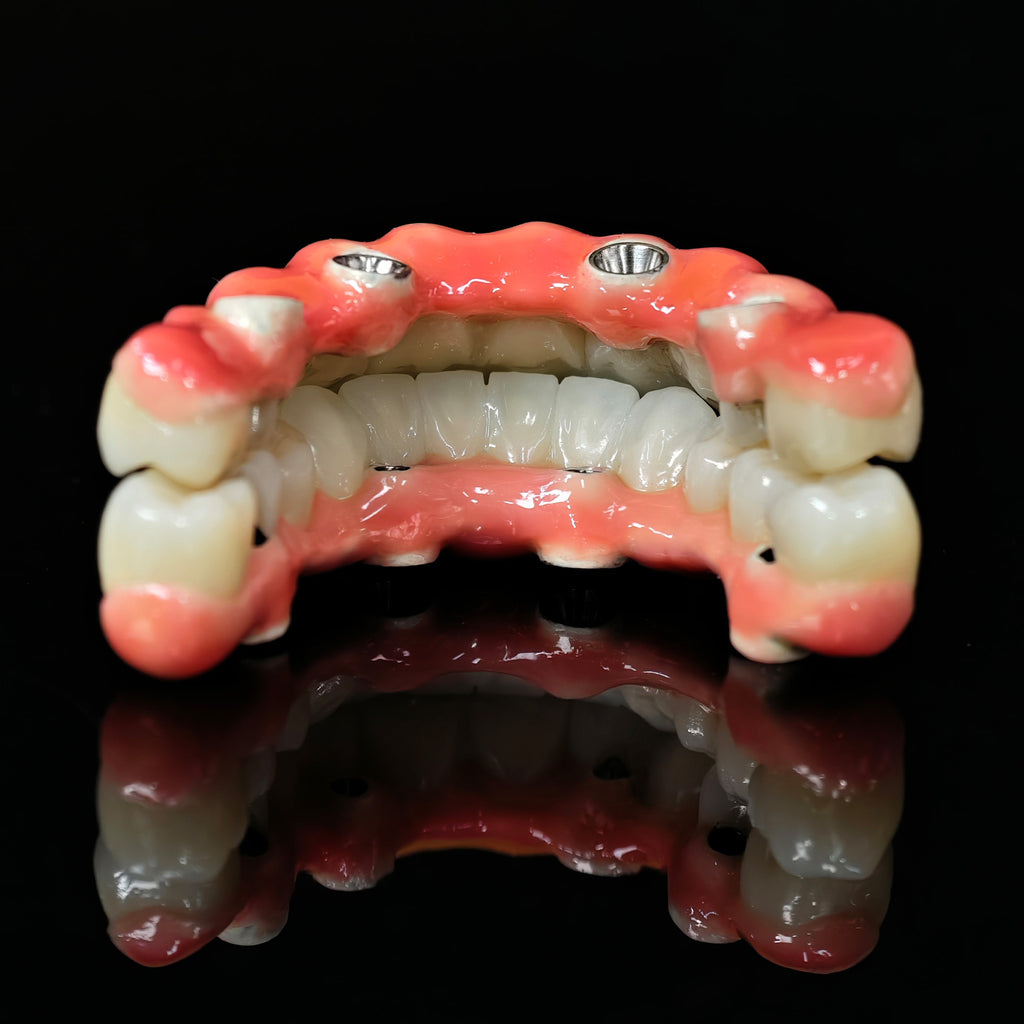 Zirconia-Enamel Hybrid Malo Bridge