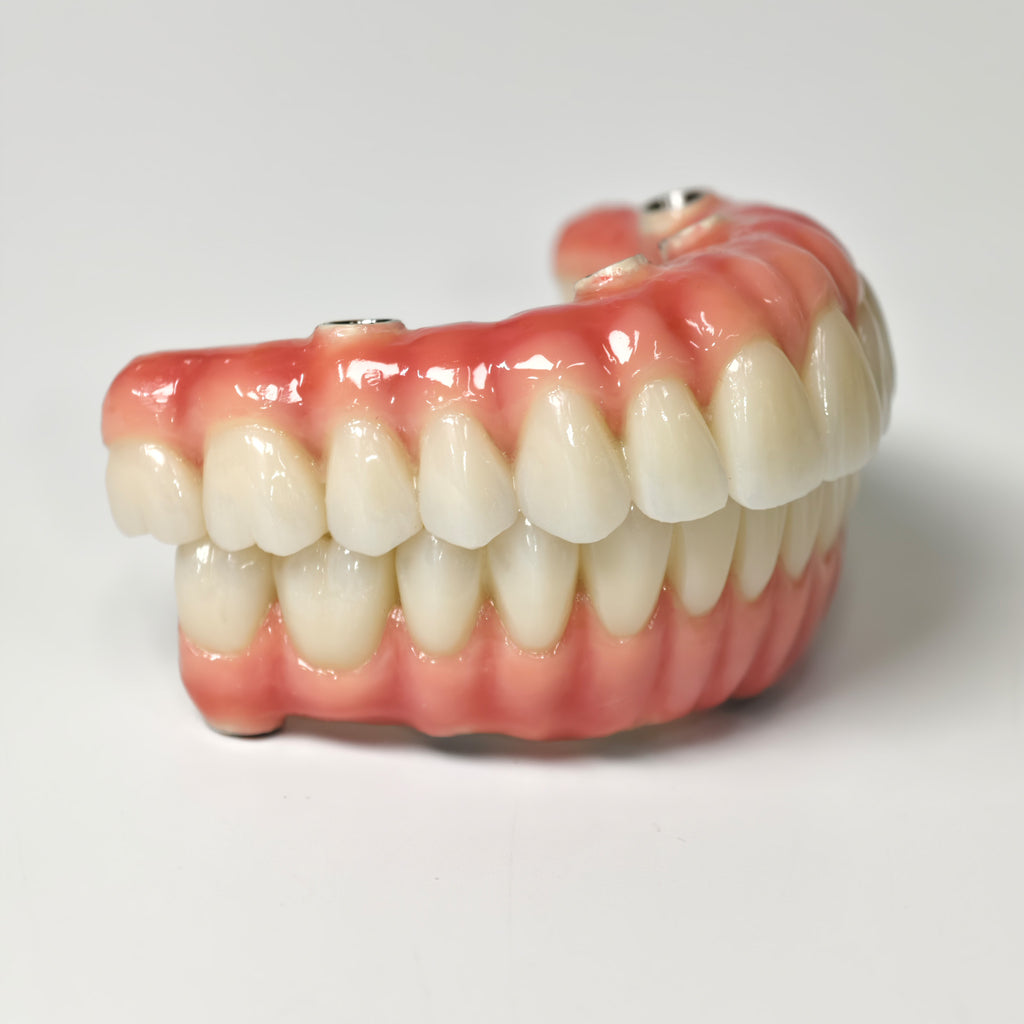 Zirconia-Enamel Hybrid Malo Bridge