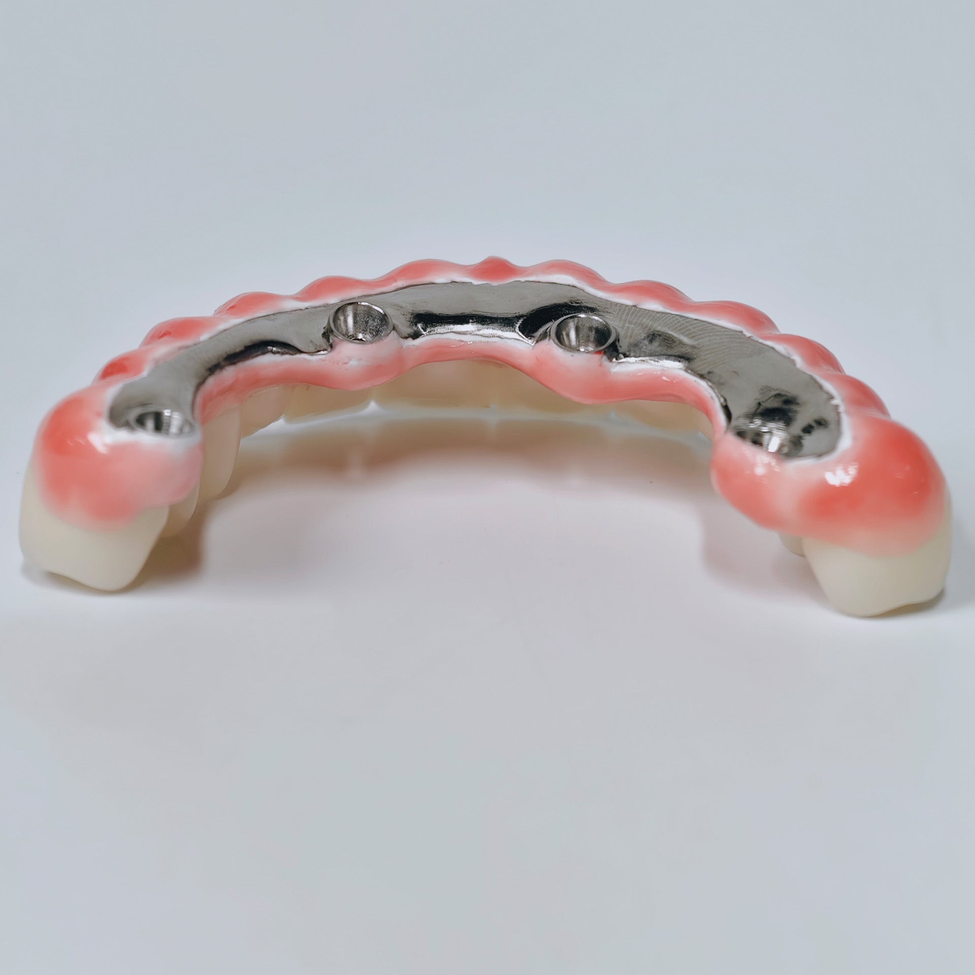 Zirconia-Enamel Hybrid Malo Bridge