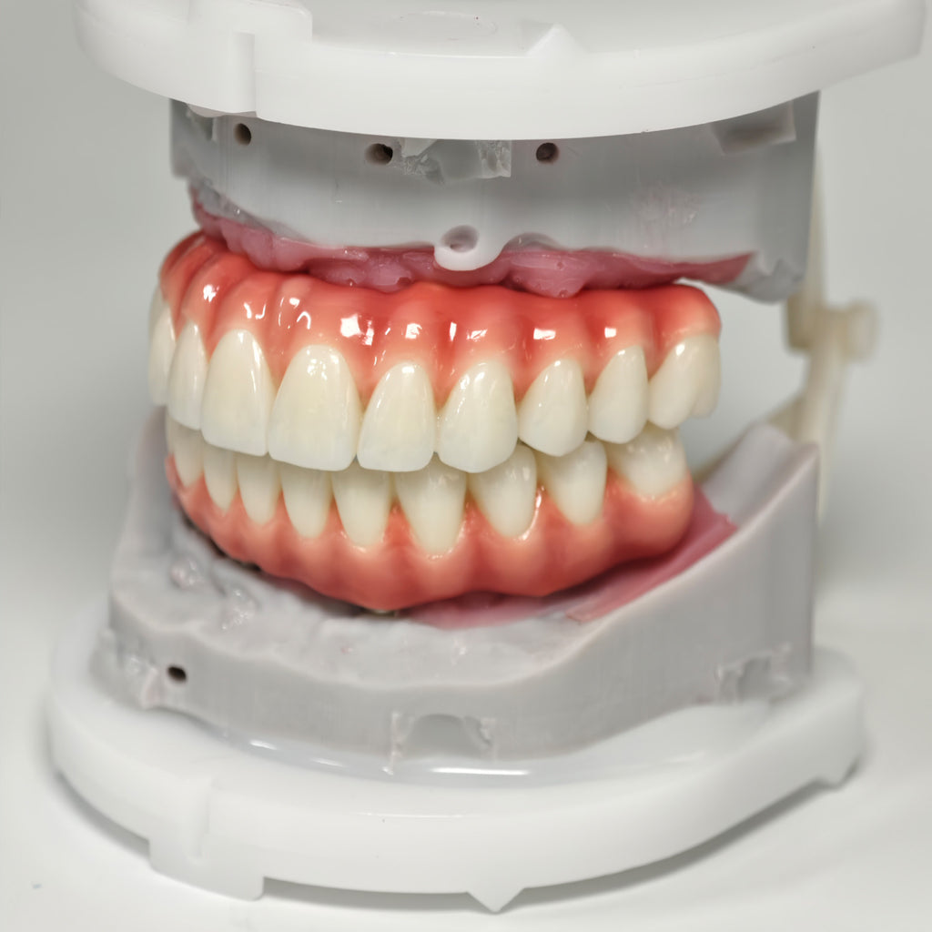 Zirconia-Enamel Hybrid Malo Bridge