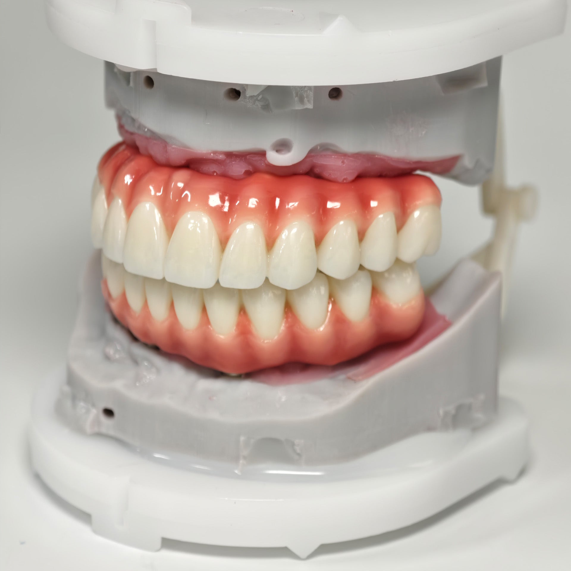 Zirconia-Enamel Hybrid Malo Bridge