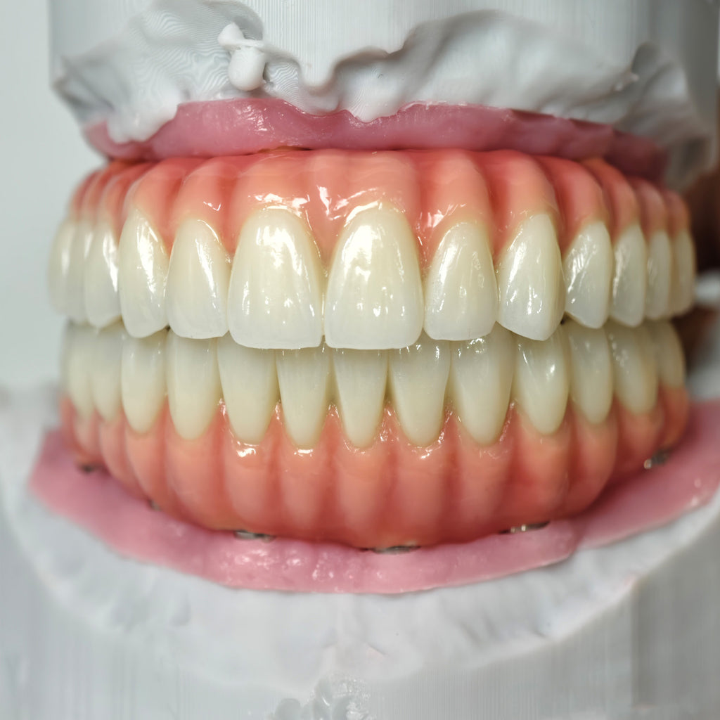 Zirconia-Enamel Hybrid Malo Bridge