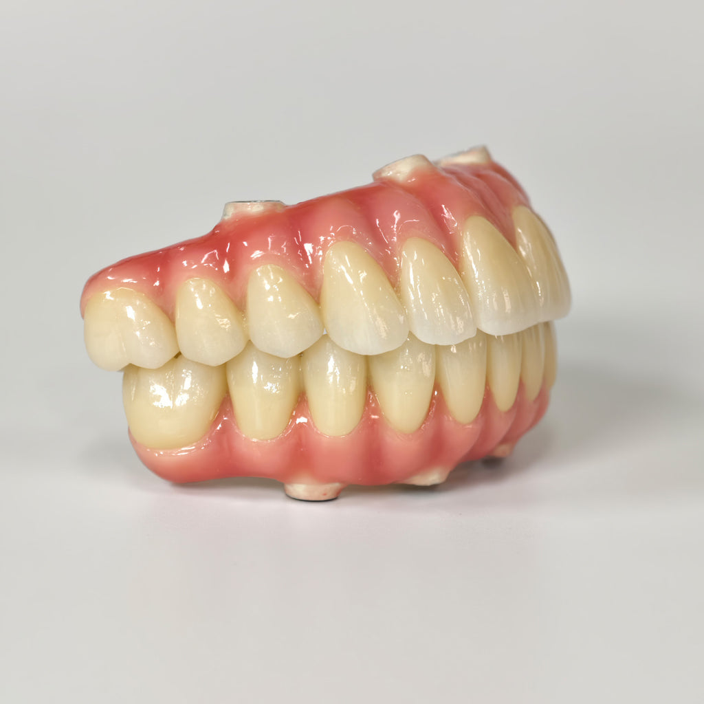 Zirconia-Enamel Hybrid Malo Bridge