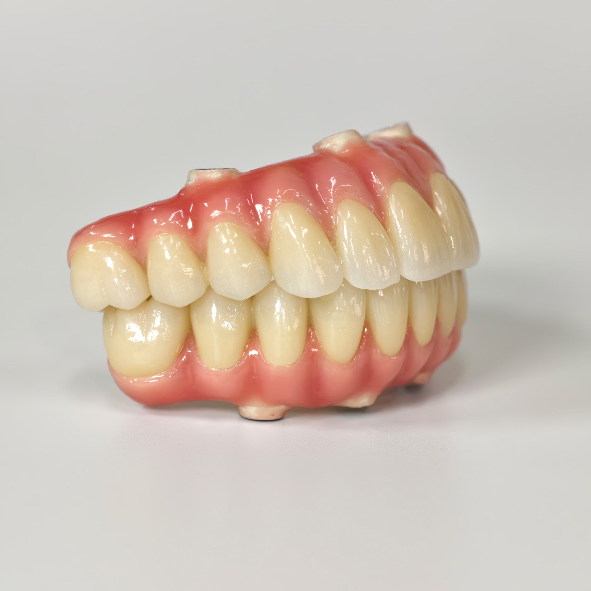 Zirconia-Enamel Hybrid Malo Bridge