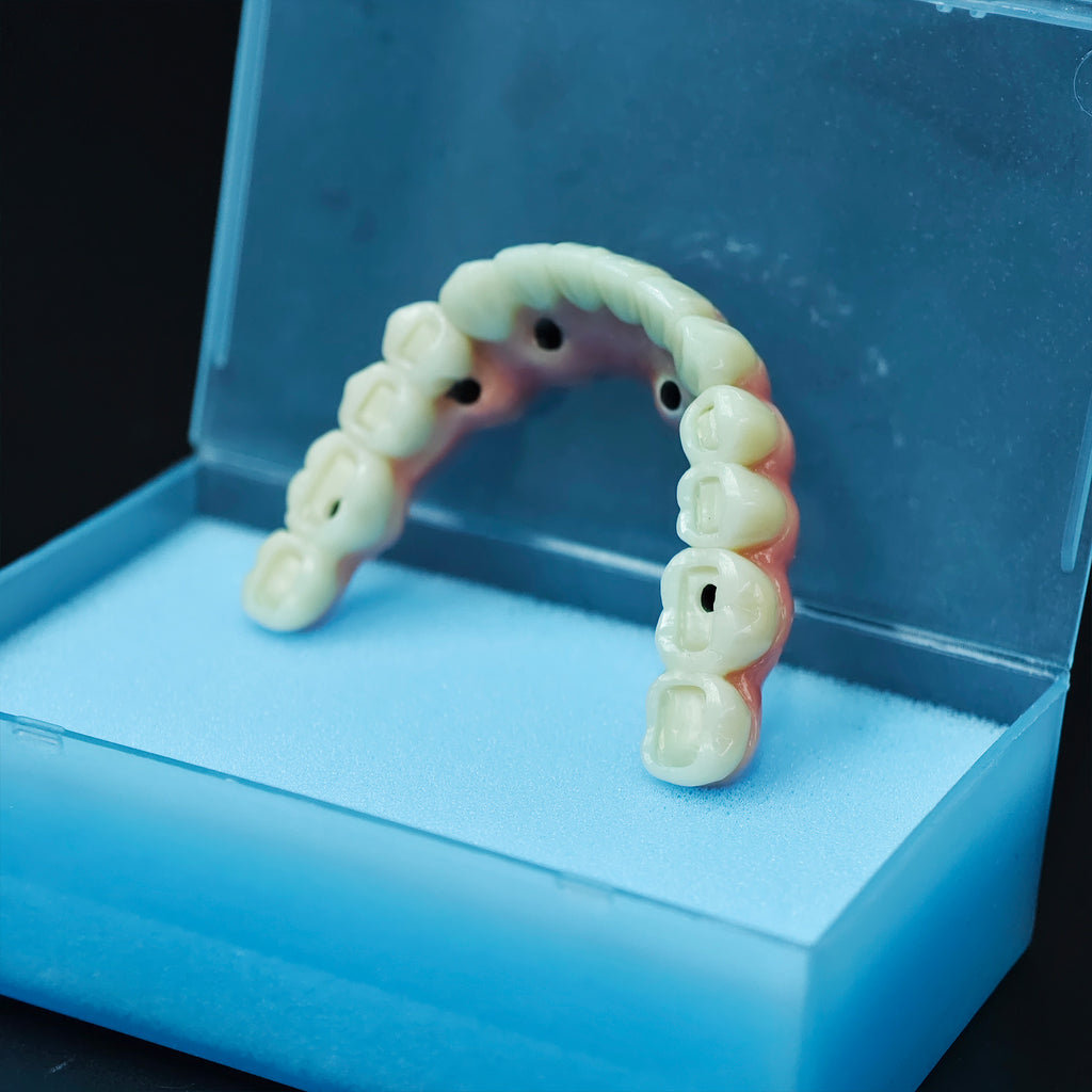 Zirconia-Enamel Hybrid Malo Bridge