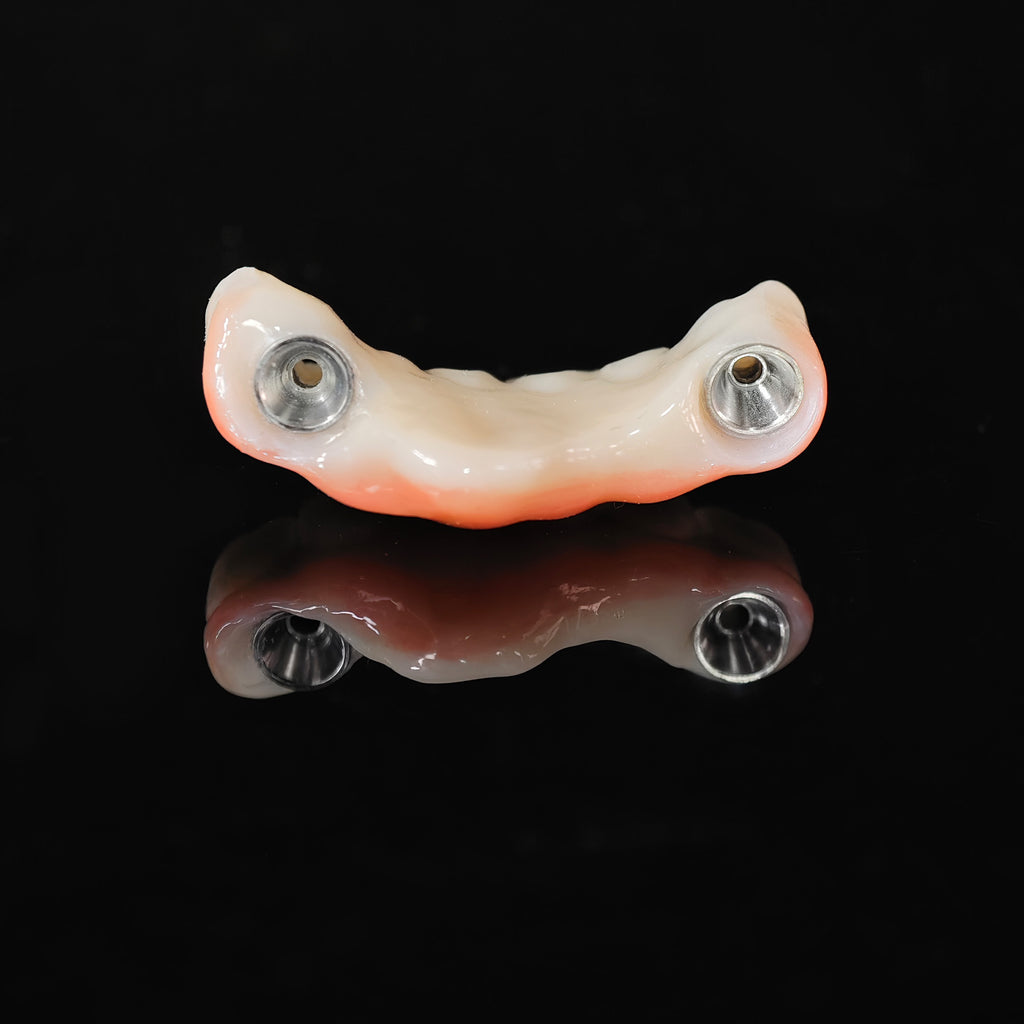 Zirconia Bridge With Ti-Base Screw Retained