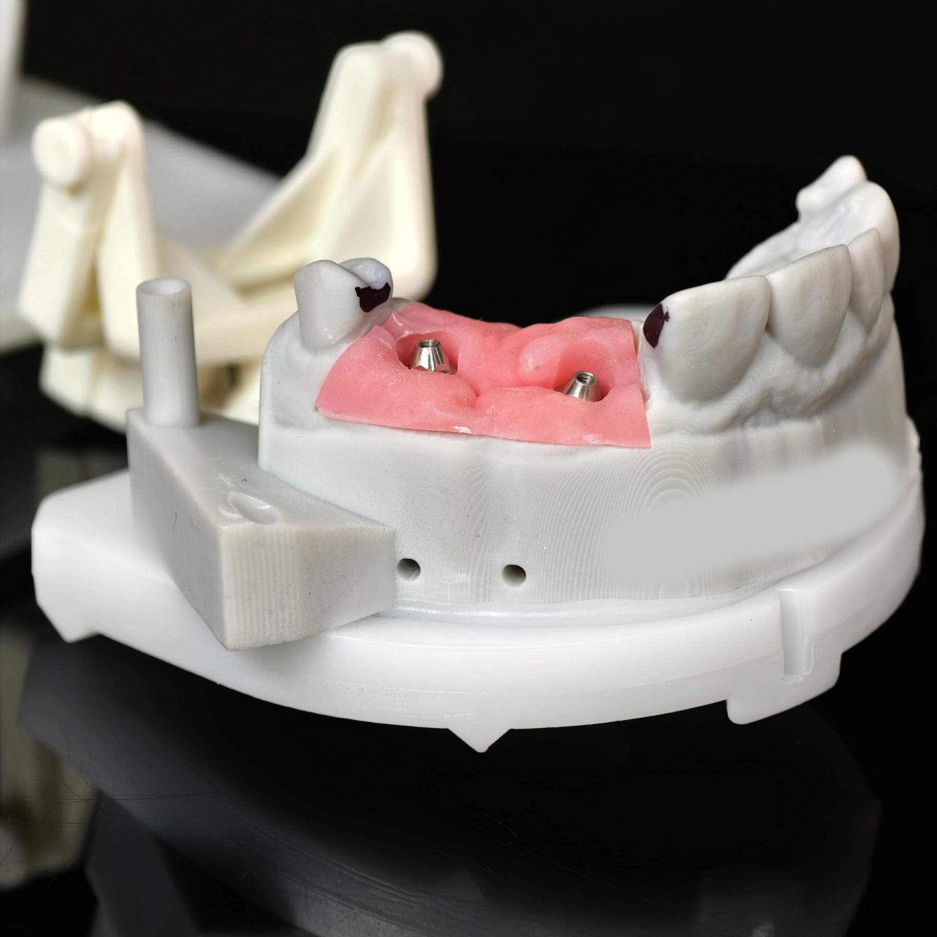 Zirconia Bridge With Ti-Base Screw Retained