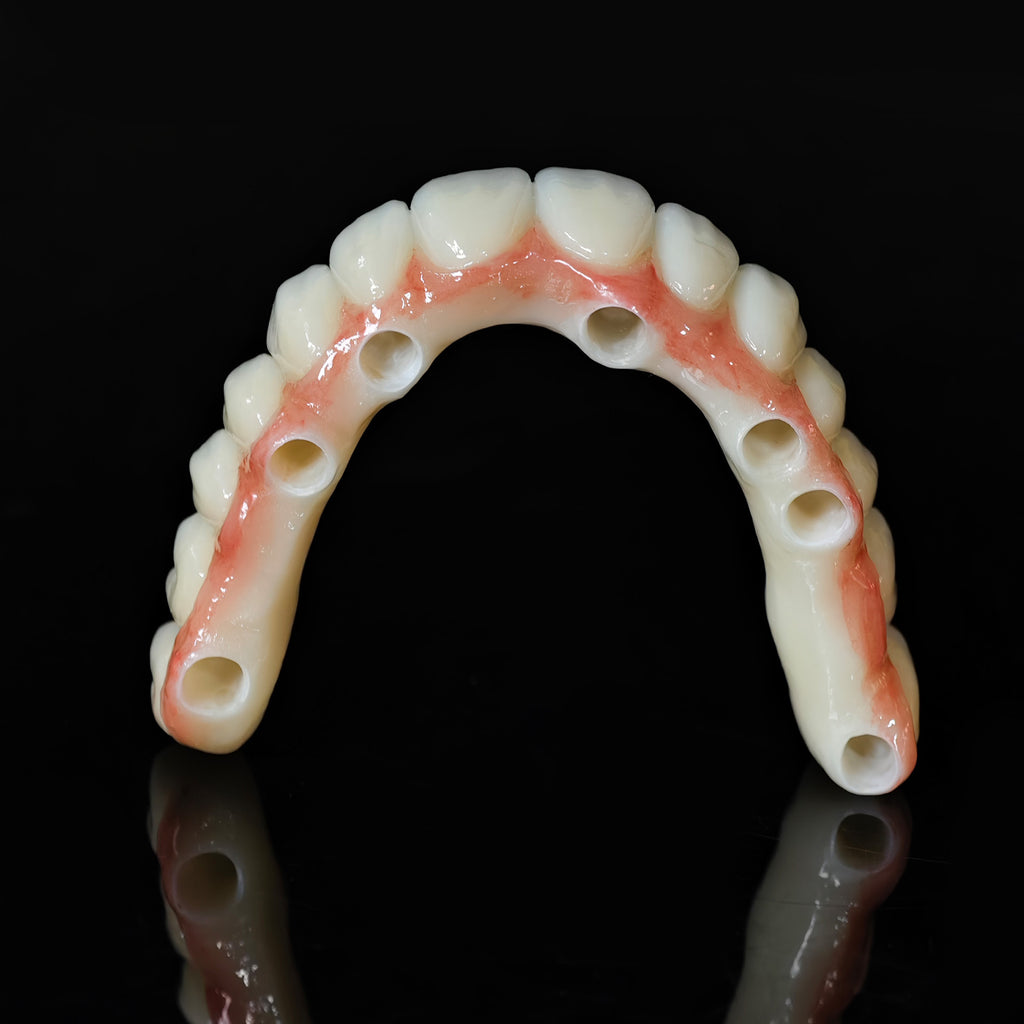 Zirconia Bridge With Cement Retained