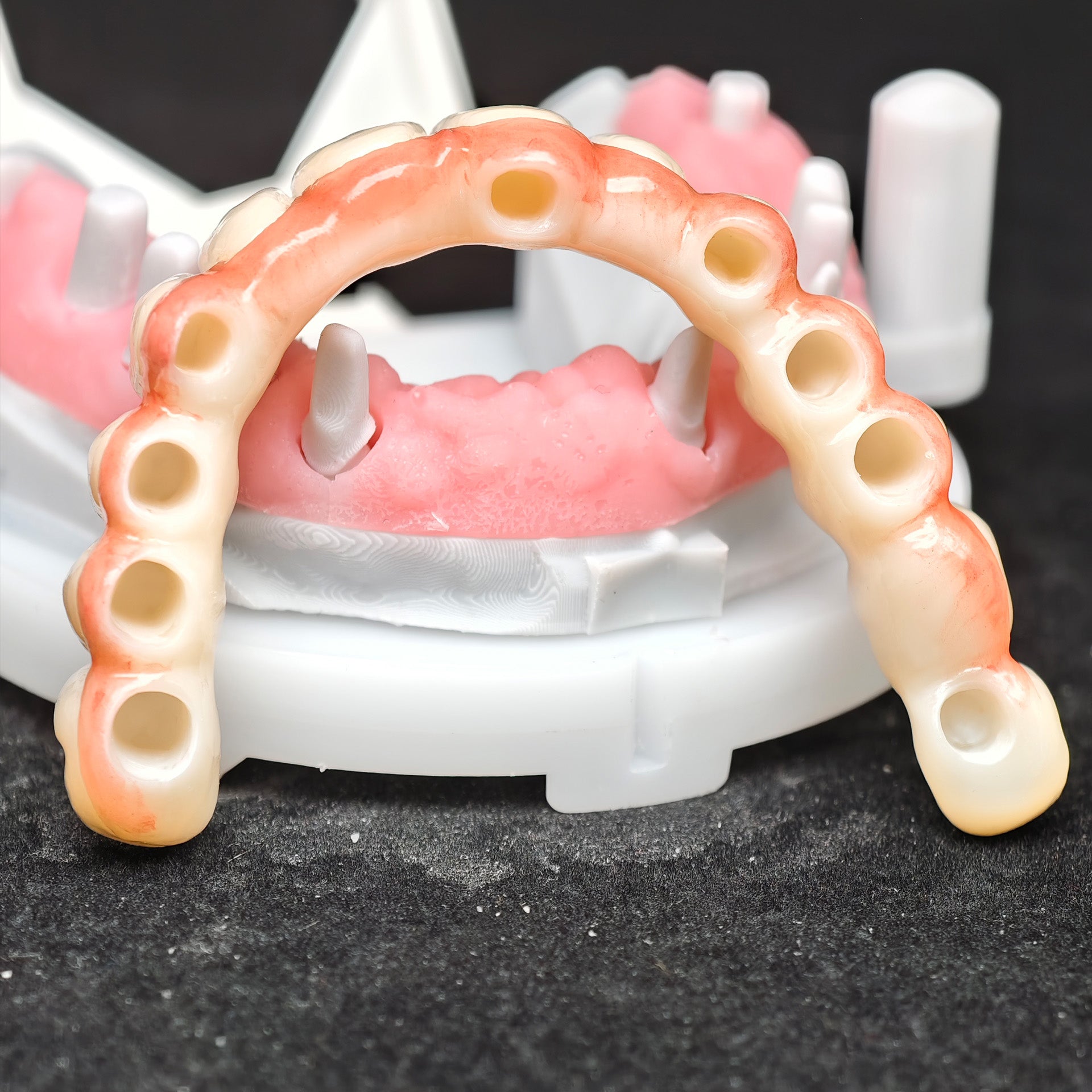 Zirconia Bridge With Cement Retained