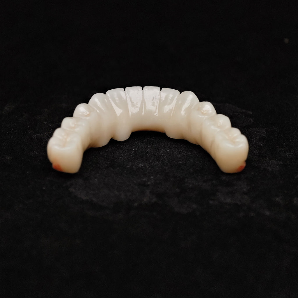 Zirconia Bridge With Cement Retained