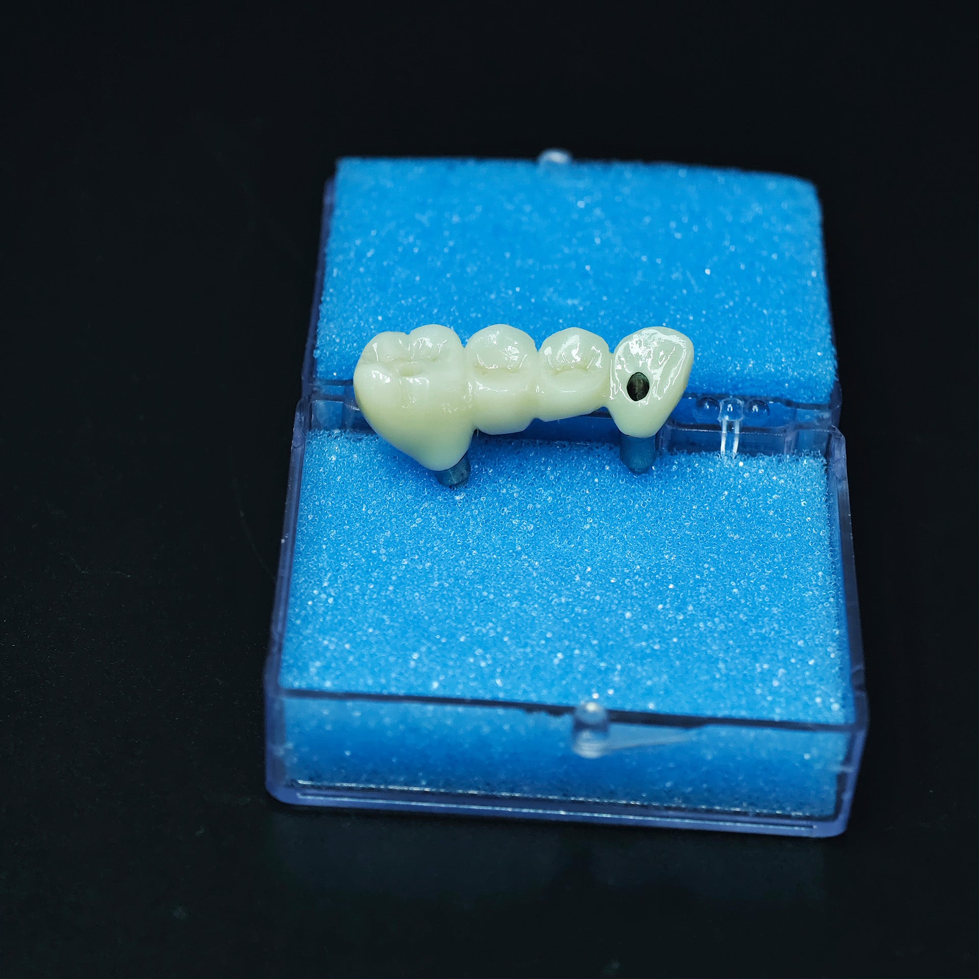 Zirconia Bridge With Screw Retained