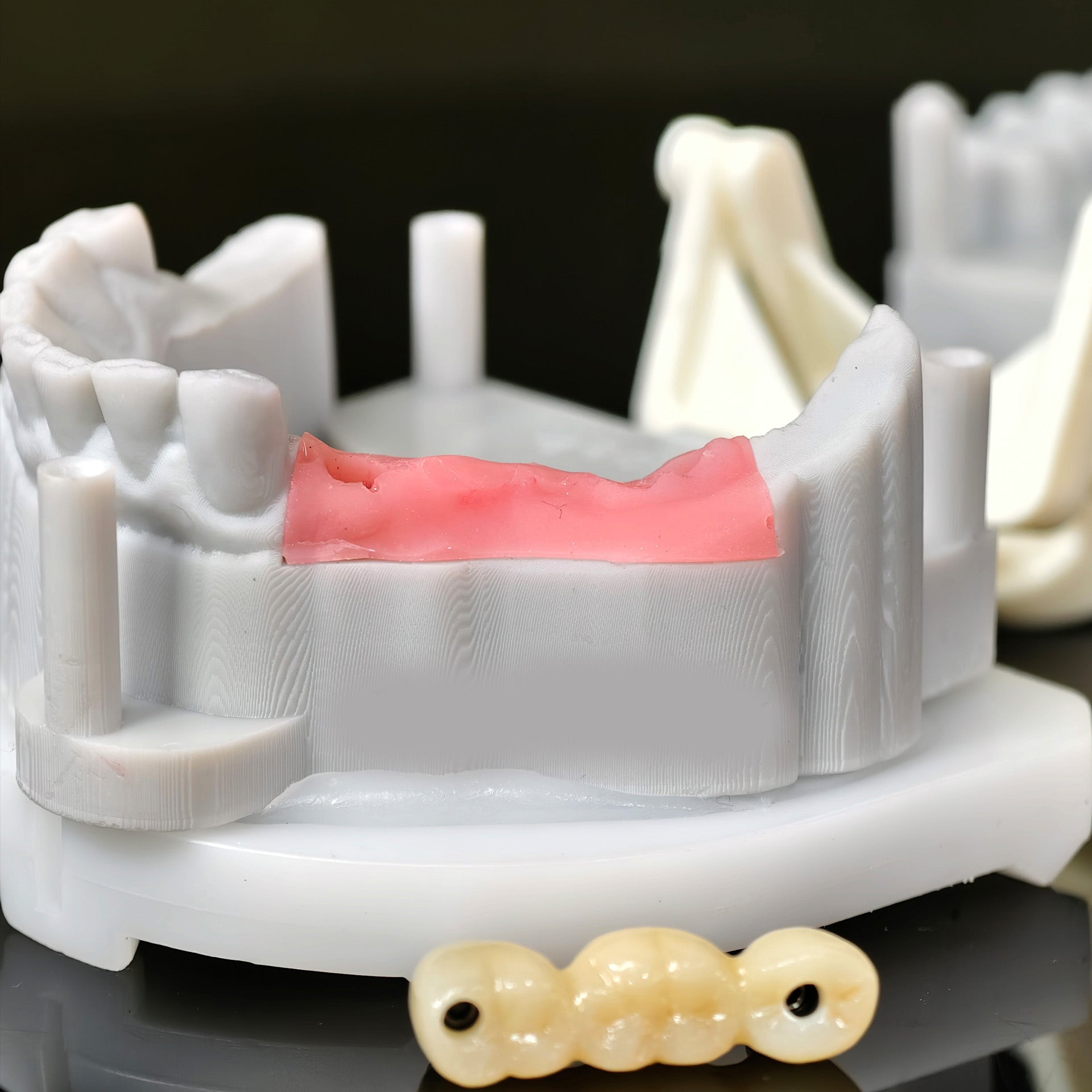 Zirconia Bridge With Screw Retained