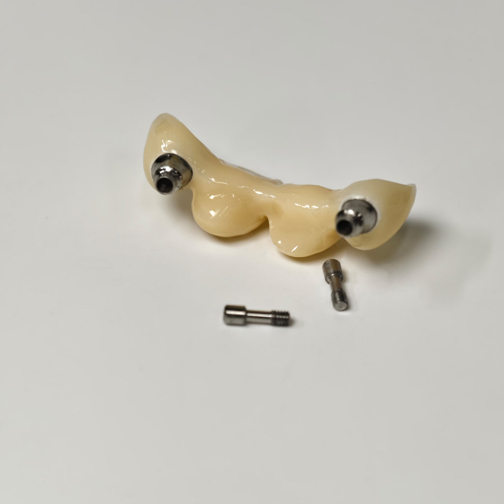 Zirconia Bridge With Screw Retained