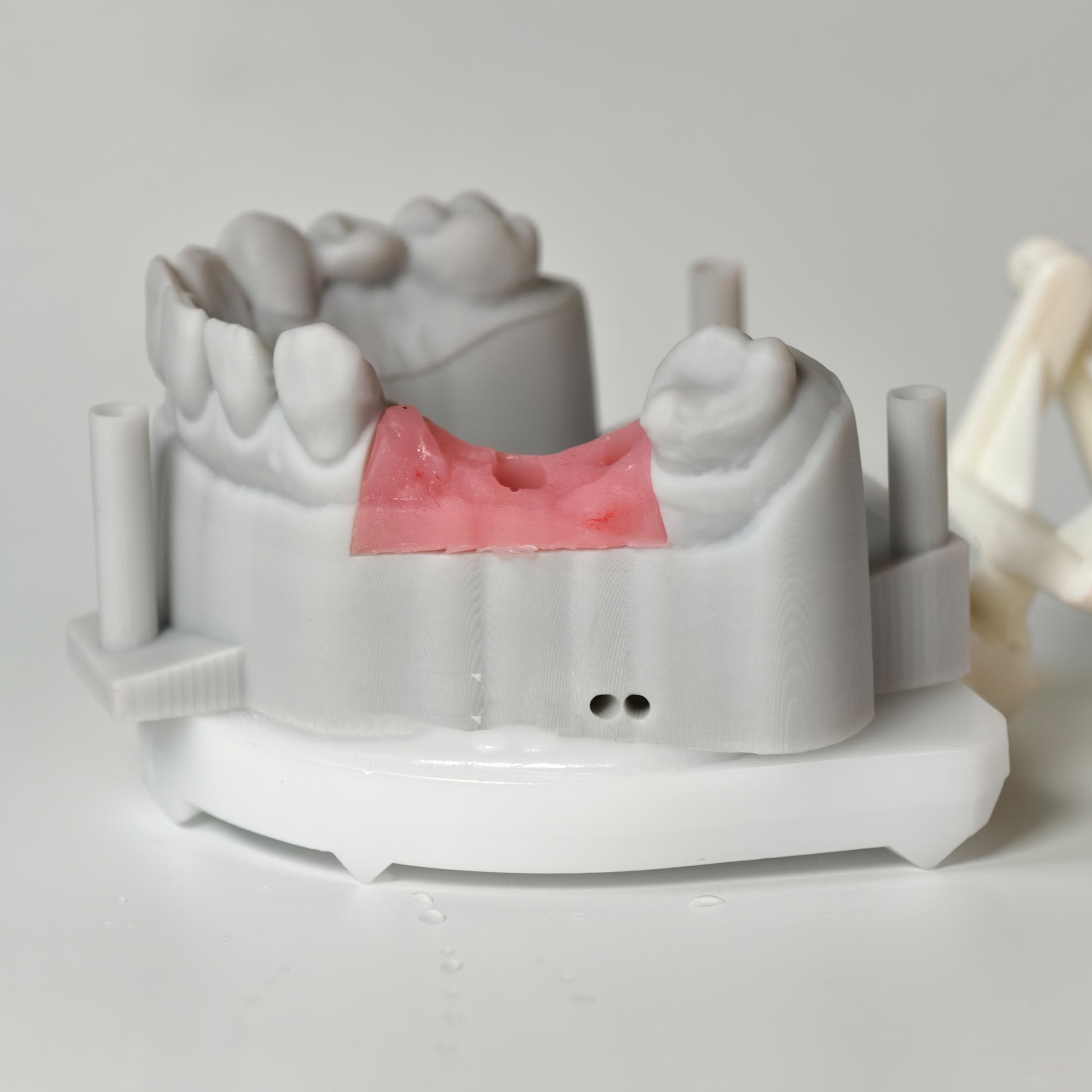 Zirconia Bridgewith Screw Retained