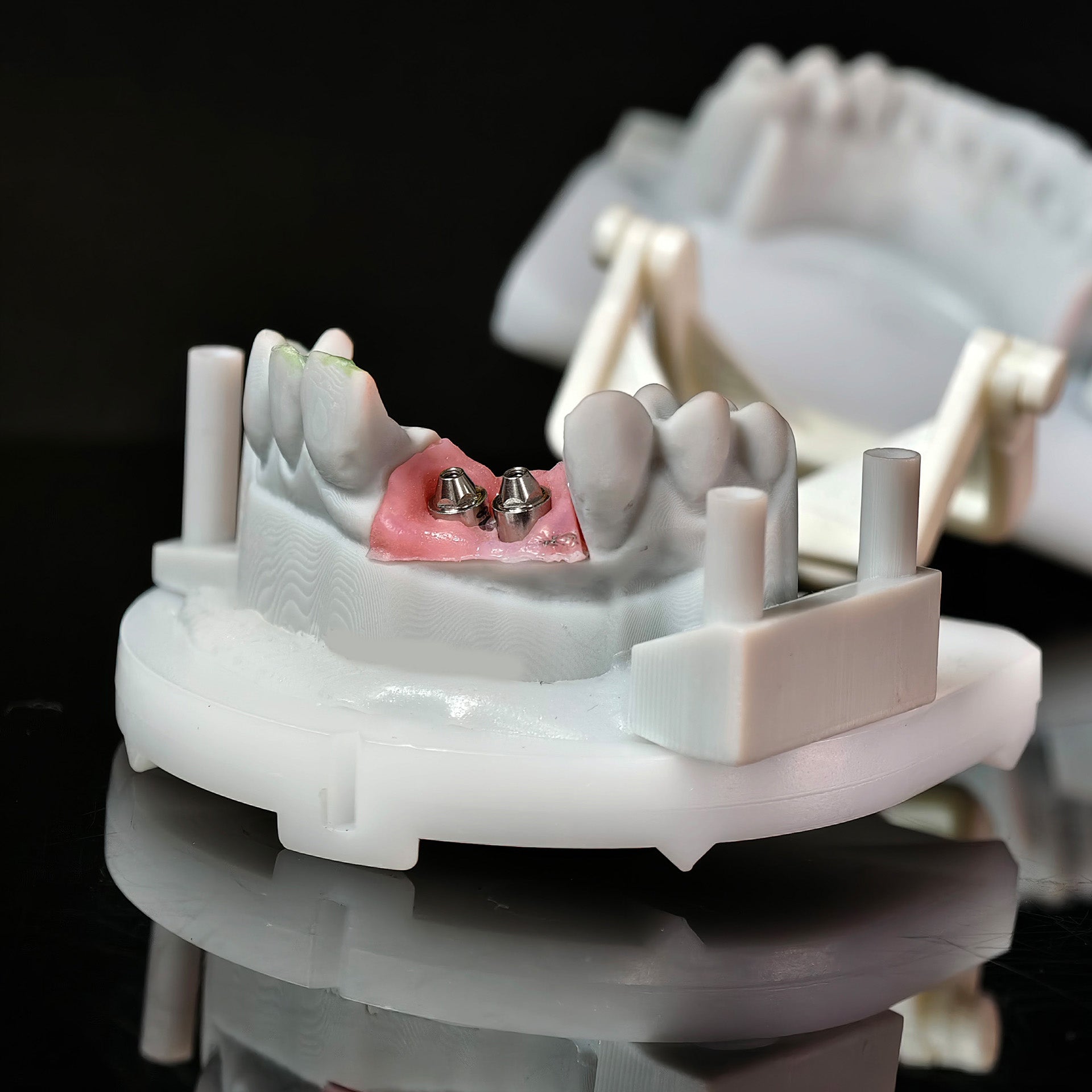 Zirconia Bridge With Ti-Base Bautment