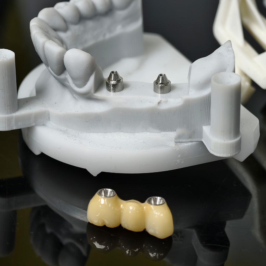 Zirconia Bridge With Ti-Base Screw Retained