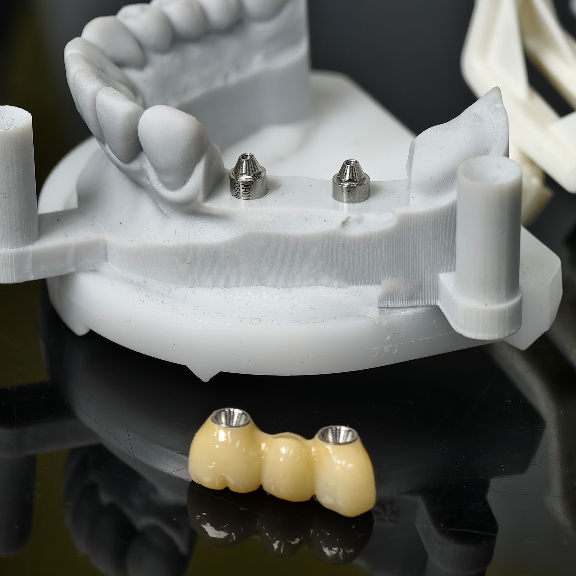 Zirconia Bridge With Ti-Base Screw Retained