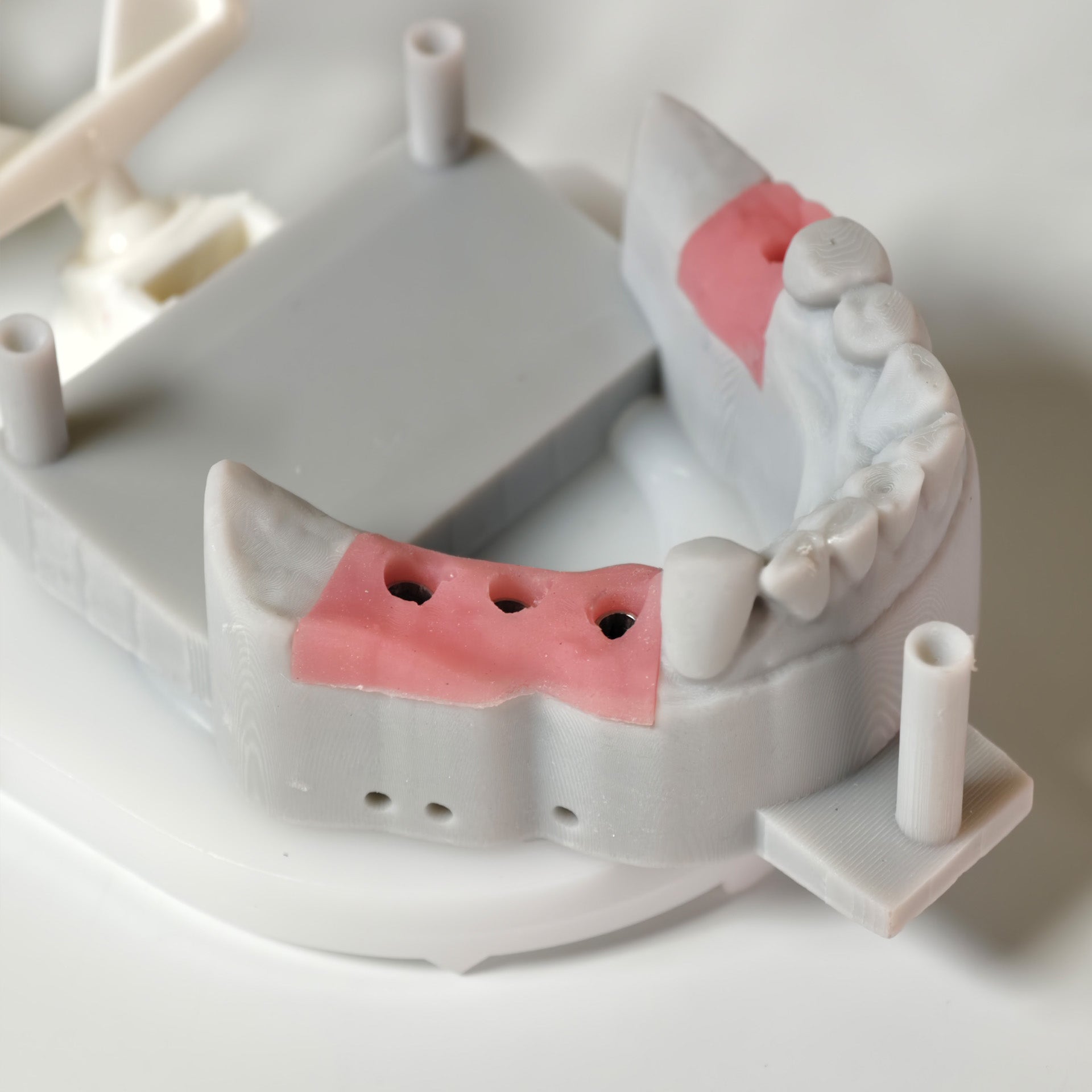 Zirconia Crowns With Screw Retained