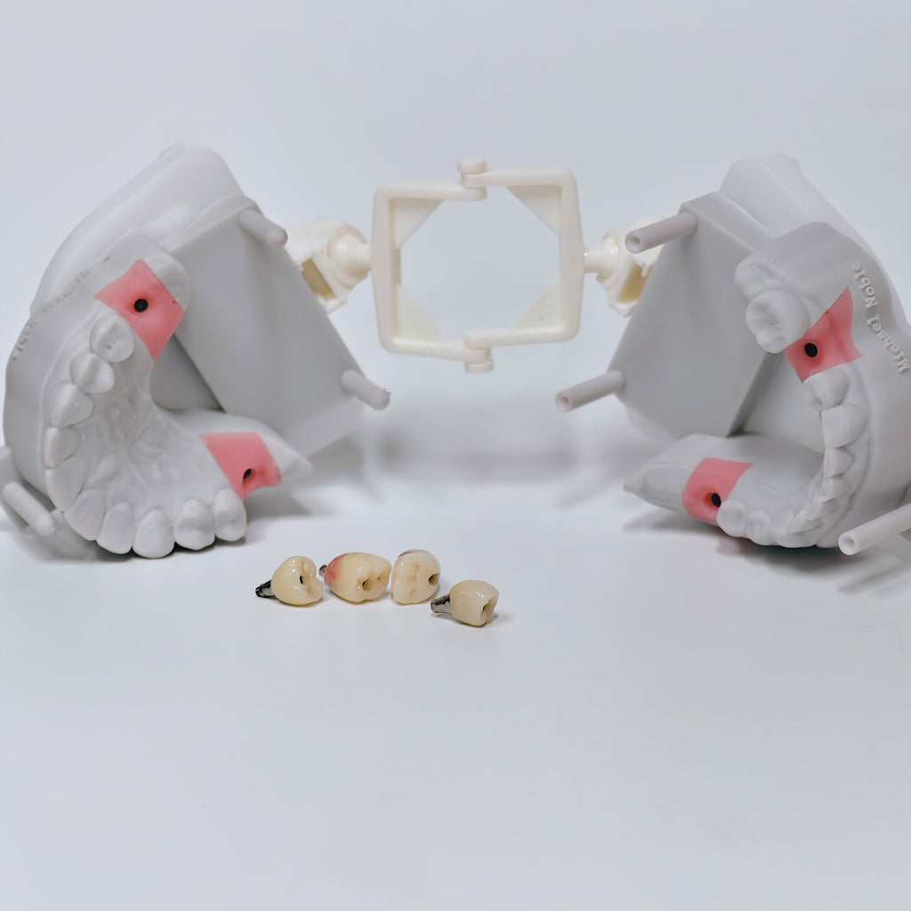 Zirconia Crowns With Screw Retained