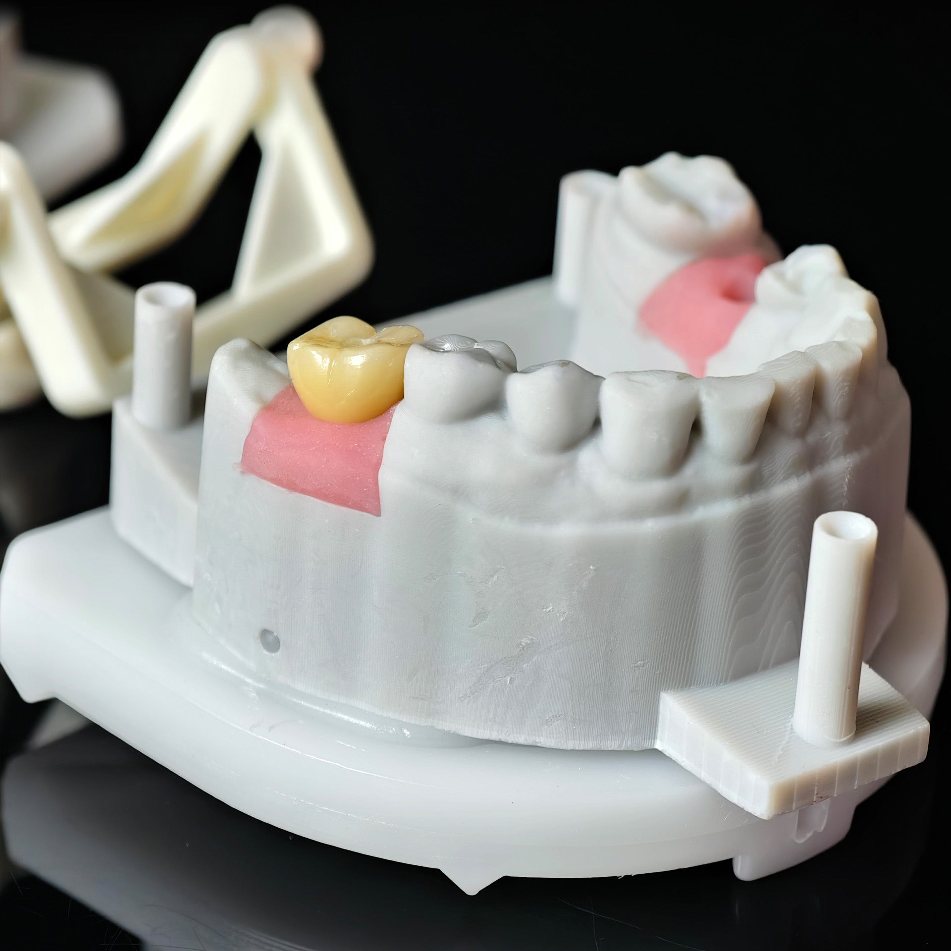 Zirconia Crowns With Screw Retained
